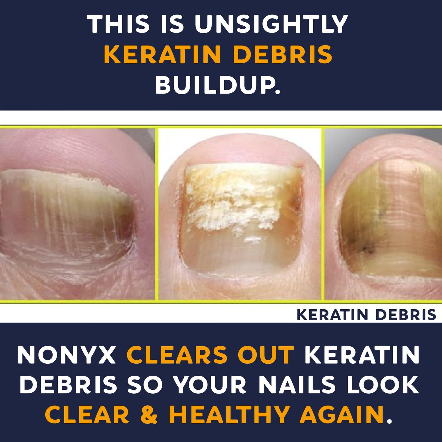 Dark Slate Gray NONYX Fungal Nail Clarifying Gel | Clinically Proven for Discolored, Thick, Brittle, Yellow, Lifted, and other signs of Fungus-Damaged Toenails | 90% of Nails Improve | Over 8 million sold