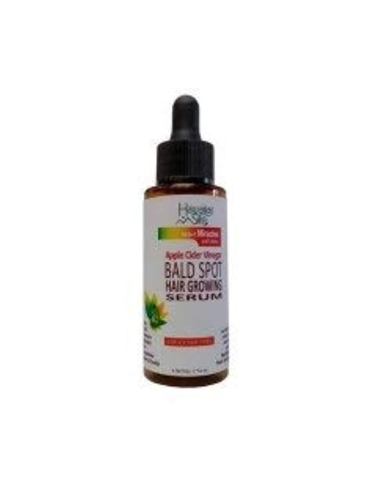 White Smoke Apple Cider Vinegar Bald Spot Recovery Serum, 1.76 fl oz - with Black Castor Oil - Hair Growth Solution for All Hair Types - Good on Color Treated Hair