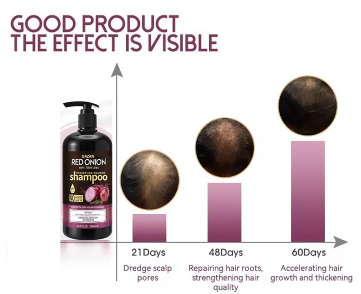 White Smoke Red Onion Shampoo Biotin Keratin 500ml- Anti Hair Loss, Anti Dandruff Shampoo for Hair Growth & Thickening - Salon Grade 100% Vegan, Nourishing Care to Restore Shine Paraben & Sulphate Free