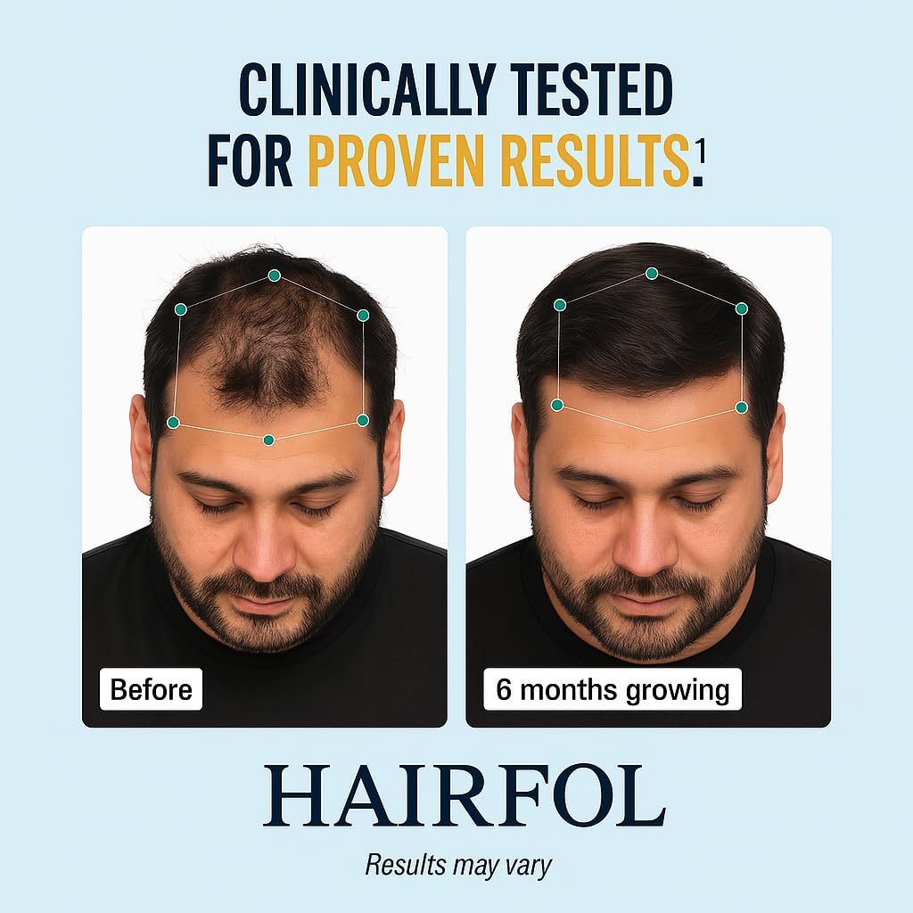 Lavender Hairfol Men's Hair Growth Supplement – Clinically Tested Hair Growth Vitamins for Men, Thicker Hair & Scalp Coverage, Hair Regrowth Support for Men – Stronger, Fuller Hair – 1 Month Supply