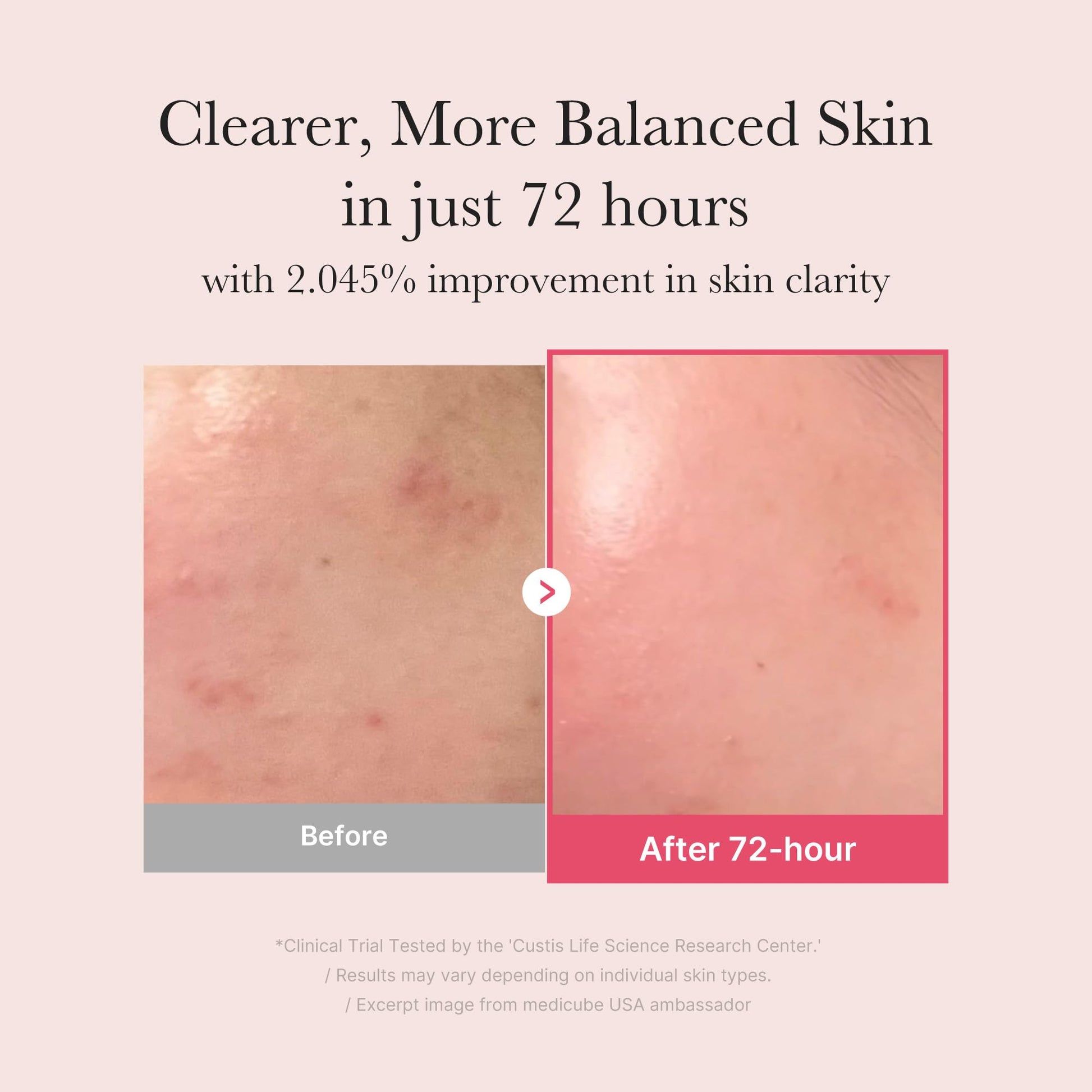 Misty Rose medicube TXA+Niacinamide 15% Glow Facial Serum for After Spot Care | All-in-One Daily Korean Skincare | Uneven Skin Tone, Texture, and Hydration Care | High-Potency Tranexamic Acid 5% | 1.01 fl.oz
