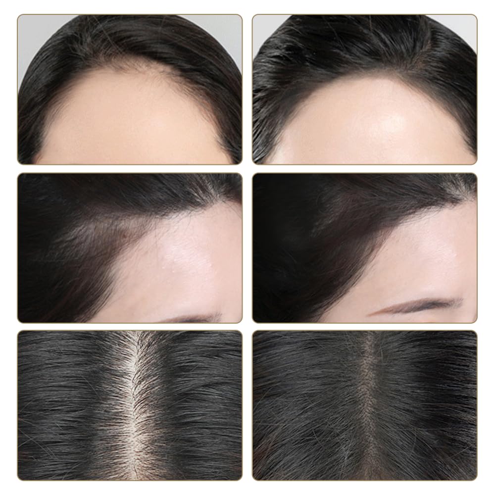 Dark Slate Gray Root Touch Up Powder, Instantly Gray Root Cover Up Hairline Powder, Hair Concealer for Women and Men (A-Black, 2PC)