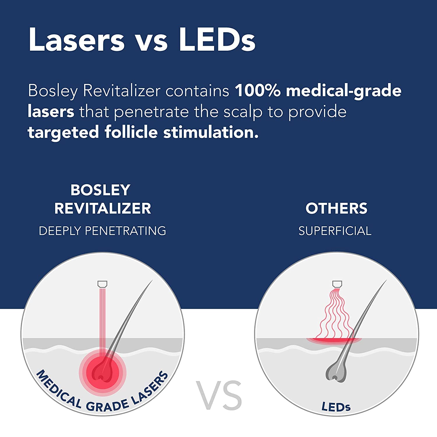 Midnight Blue Bosley Revitalizer Flex 164 Diode 100% Laser No LEDs Hair Growth Cap (LLLT) Men and Women - Regrowth, Home Treatment, Thicker, Fuller, Healthy Hair, FDA Cleared. Large Size