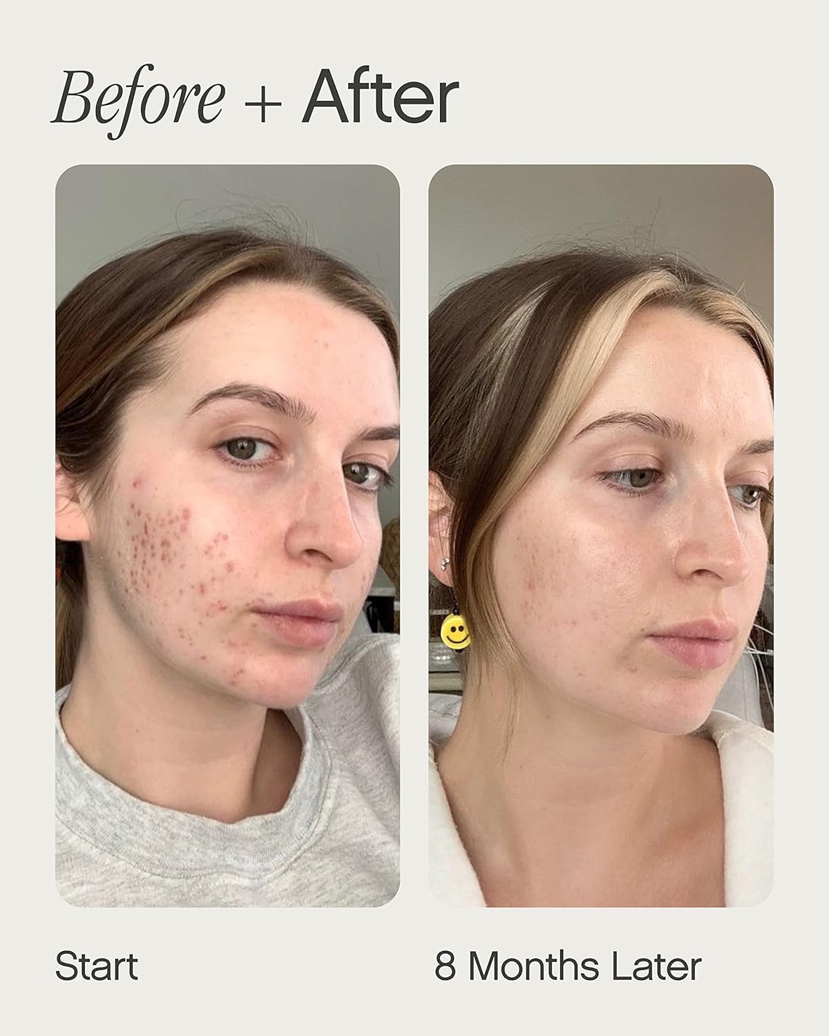 Lavender Topicals Faded Brightening and Clearing Serum | Reduces Discoloration, Post-Blemish Marks, Scars and Spots | Contains Kojic Acid and Niacinamide | Dermatologist-tested, Vegan, Cruelty-Free (0.5 Fl Oz)