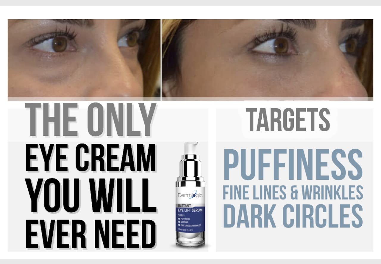 White Smoke Under Eye Puffiness & Dark Circles Rapid Treatment- Instantly Reduces the Appearance of Puffy Eye Bags, Crow’s Feet, & Sagging Skin.