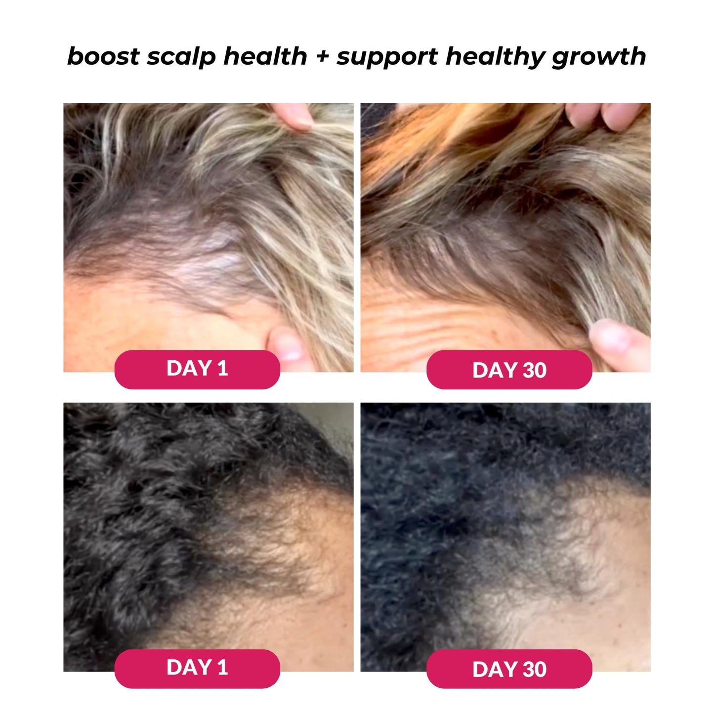 White Smoke Love Ur Curls - Healthy Scalp Serum Growth Hair Activator, Turmeric & Basil Extracts for Deep Moisturizing and Thicker Full Hair, Vegan, 50mL