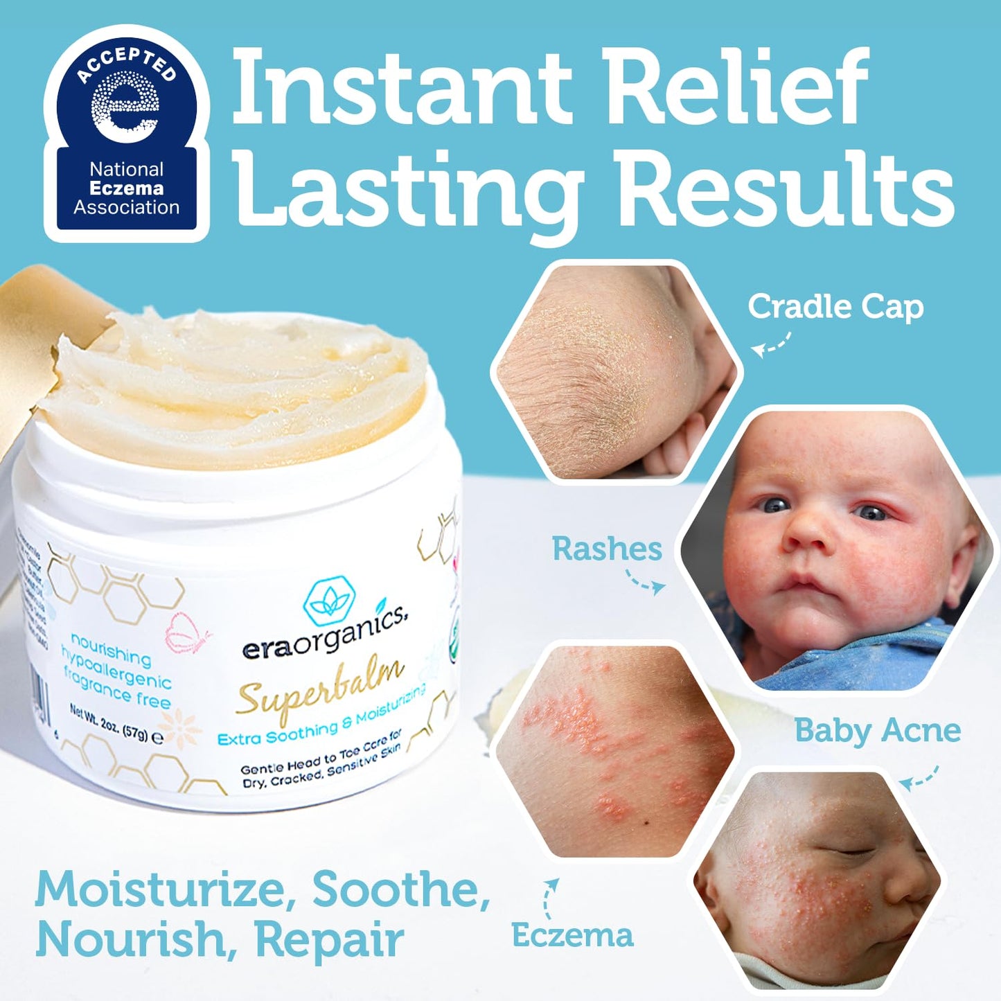 White Smoke Era Organics Healing Ointment for Babies - USDA Certified Organic Natural Moisturizer Gentle on Sensitive Skin Prone To Baby Eczema, Cradle Cap (Infant Seborrheic Dermatitis), Rashes, Hives and More