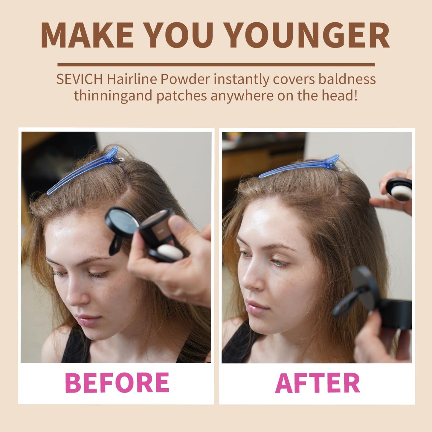 White Smoke Sevich Hairline Powder,Instantly Conceals Hair Loss, Root Touch up Powder, Hair Shadow Toppers for Women & Men, Touch Up for Thinning Gray Hair, Windproof & Sweatproof,Dark brown