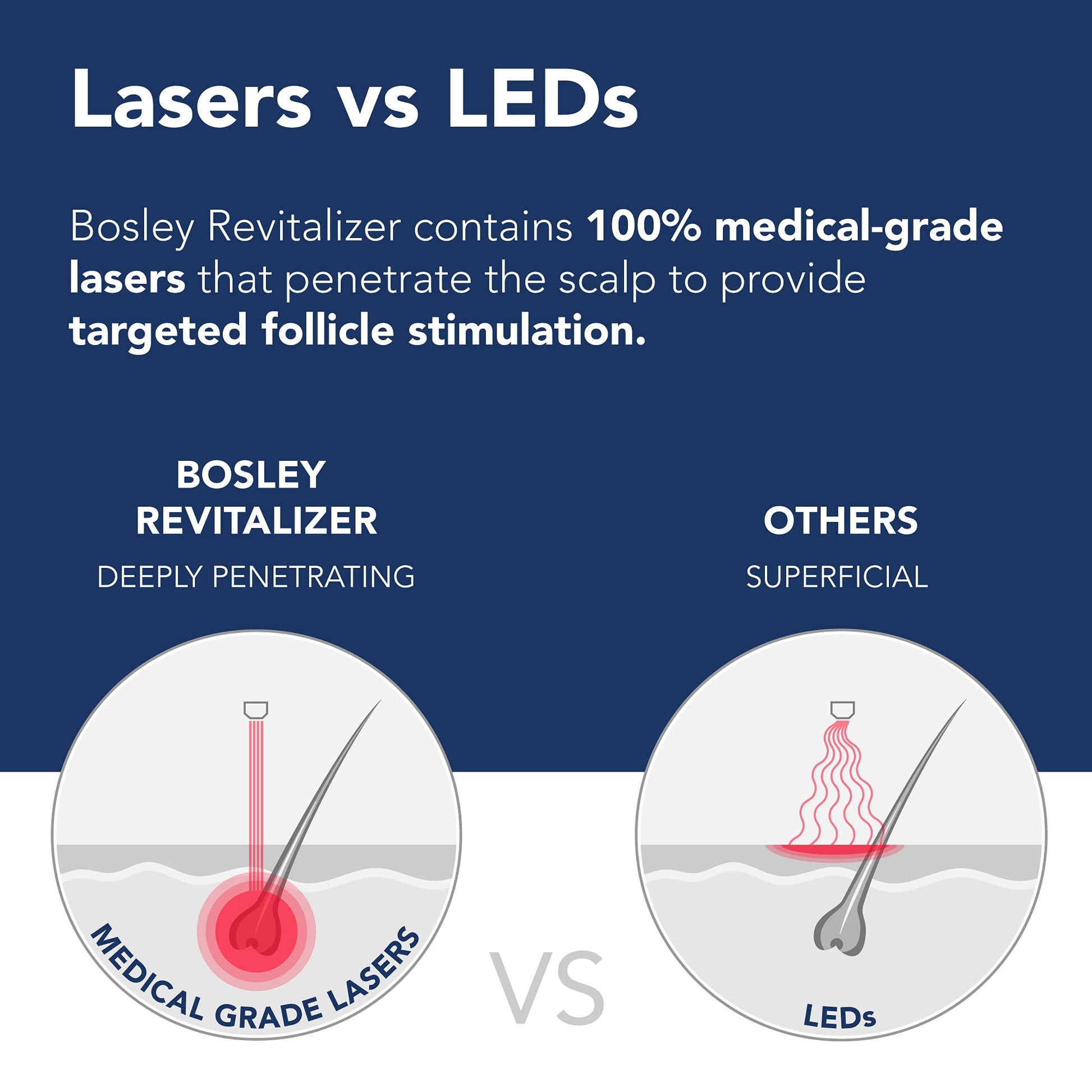Midnight Blue Bosley Revitalizer 272 Flex 100% Laser No LEDs Hair Growth Cap (LLLT) Men and Women - Regrowth, Home Treatment, Thicker, Fuller, Healthy Hair, FDA Cleared, Large Size