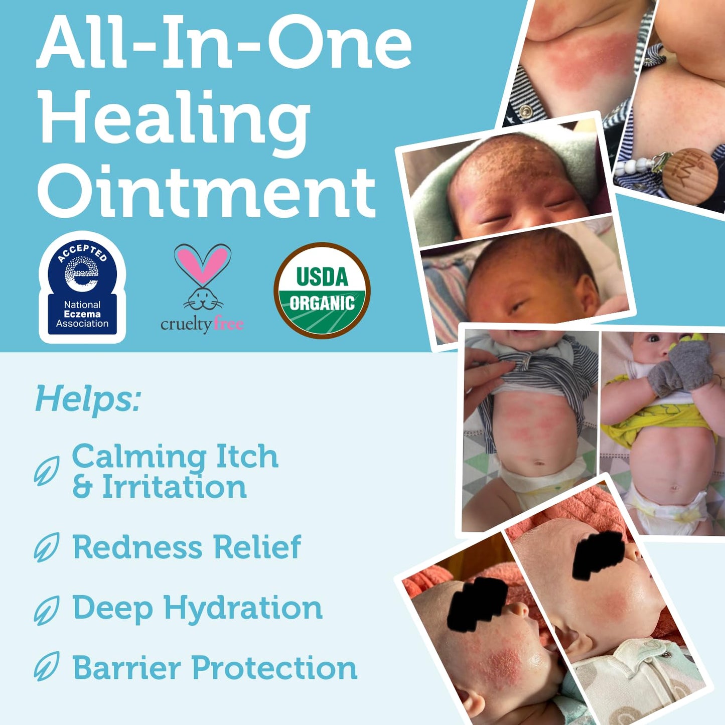 Alice Blue Era Organics Healing Ointment for Babies - USDA Certified Organic Natural Moisturizer Gentle on Sensitive Skin Prone To Baby Eczema, Cradle Cap (Infant Seborrheic Dermatitis), Rashes, Hives and More