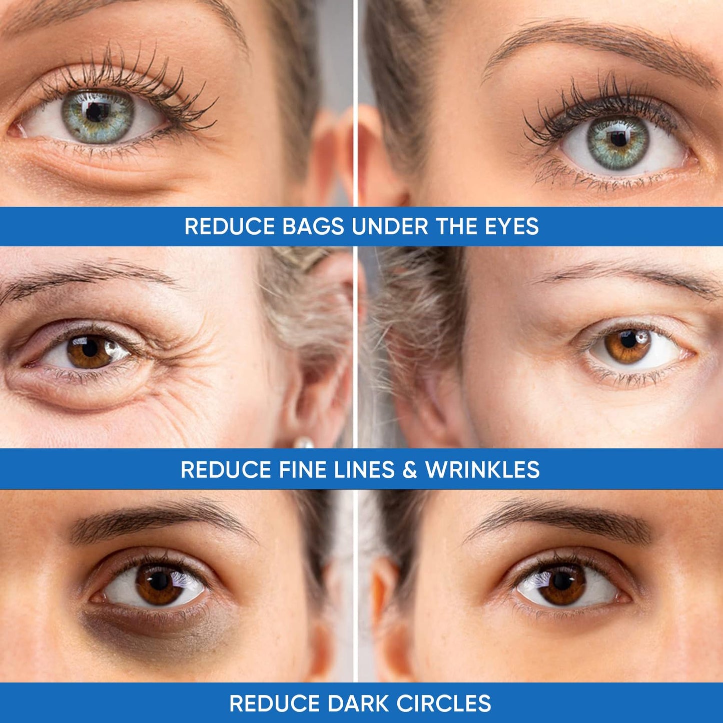 Bisque Under Eye Puffiness & Dark Circles Rapid Treatment- Instantly Reduces the Appearance of Puffy Eye Bags, Crow’s Feet, & Sagging Skin.