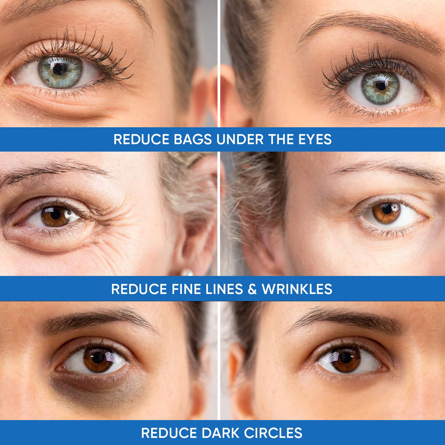 Bisque Under Eye Puffiness & Dark Circles Rapid Treatment- Instantly Reduces the Appearance of Puffy Eye Bags, Crow’s Feet, & Sagging Skin.