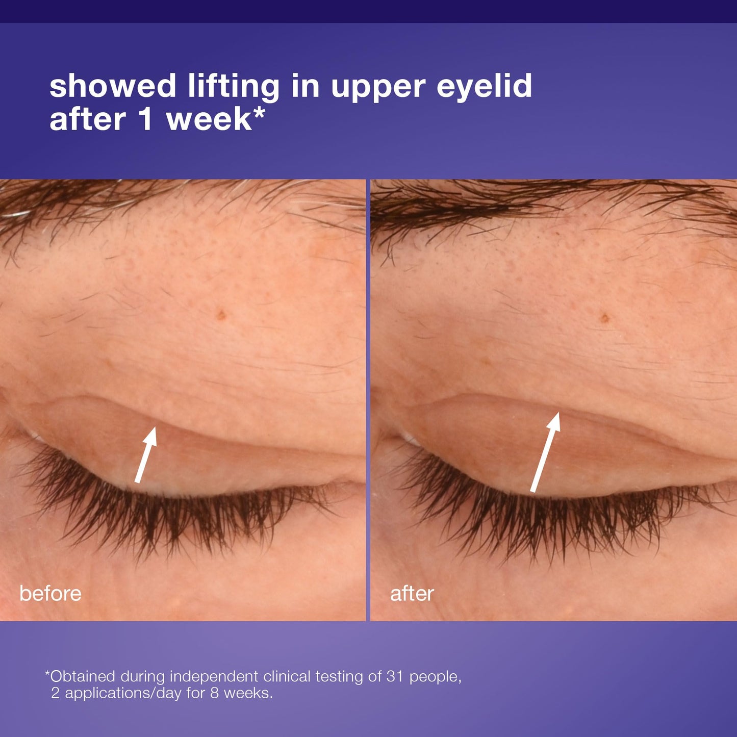 Dark Salmon Dermalogica Phyto Nature Lifting Eye Cream, Skin Treatment Serum for Around Eyes - Reduces the Appearance of Fine Lines and Wrinkles