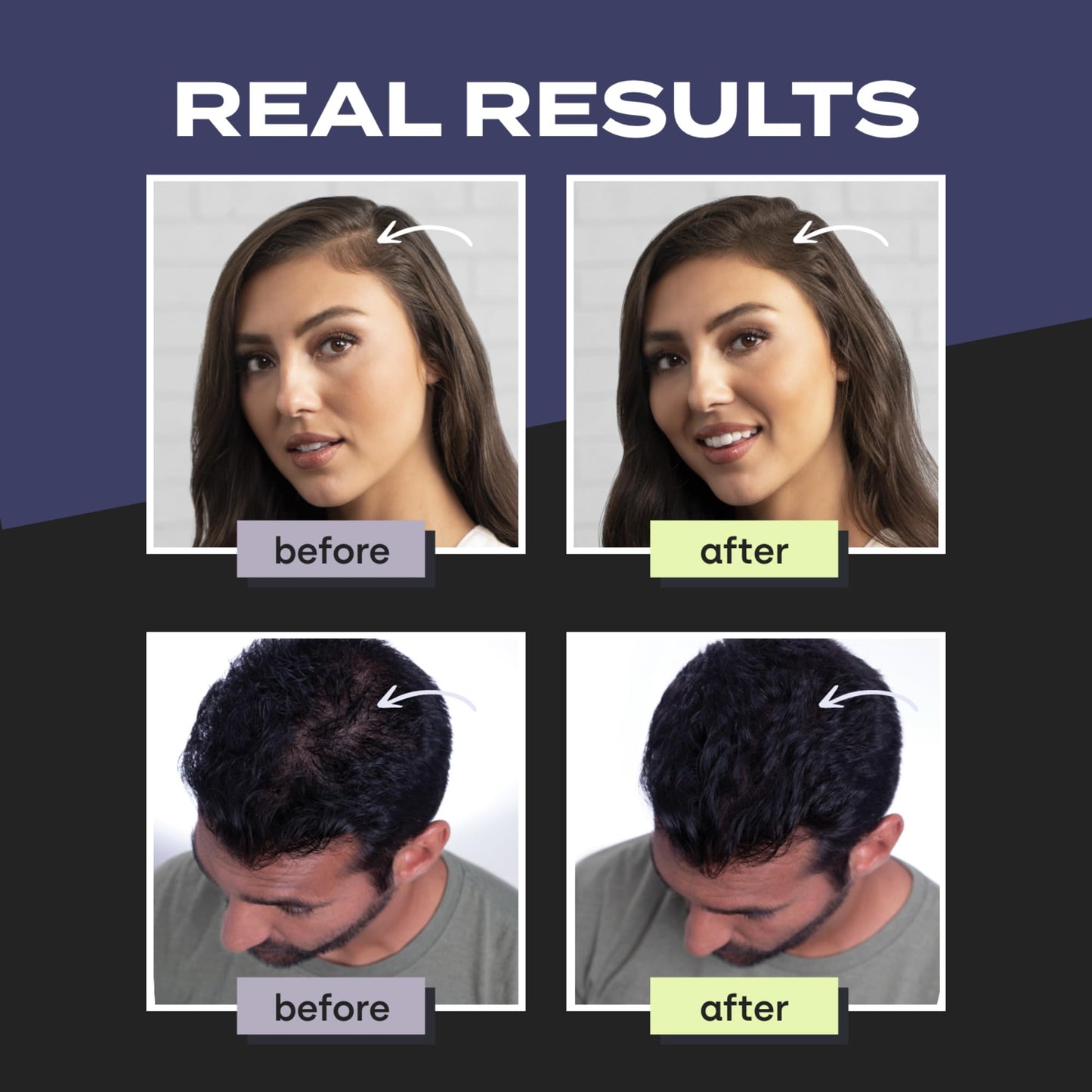 Dark Slate Gray Toppik Hair Building Fibers, Black, 12g Fill In Fine or Thinning Hair, Instantly Thicker, Fuller Looking, 9 Shades for Men & Women, Keratin Protein Formula