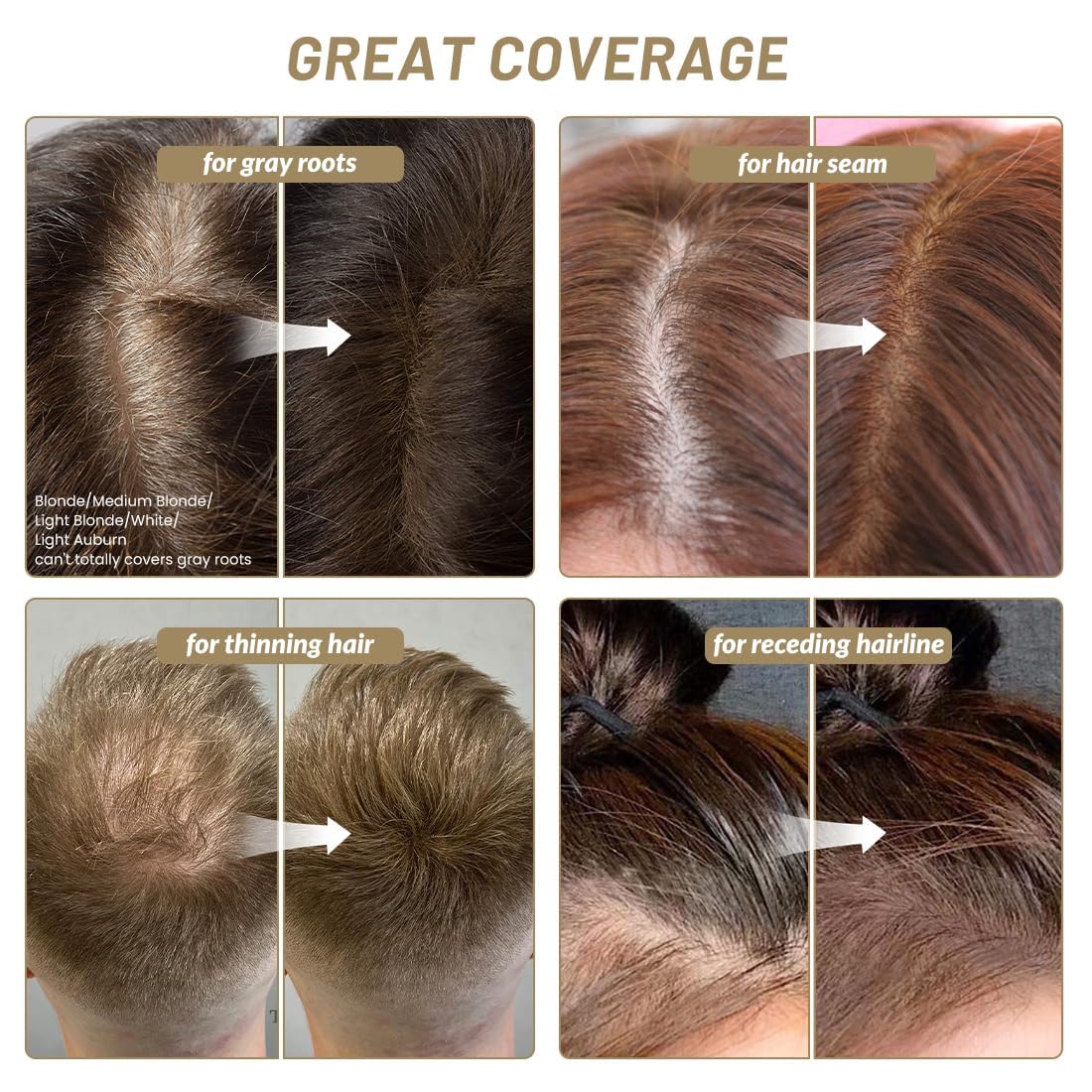 White Smoke SOVONCARE Instantly Hairline Powder, Hairline Shadow Gray Hair Coverage Touch Up Hair Powder for Thinning Hair for Women Hair Root Touch Up Powder Hair Root Cover Up Conceals Hair Loss Dark Brown