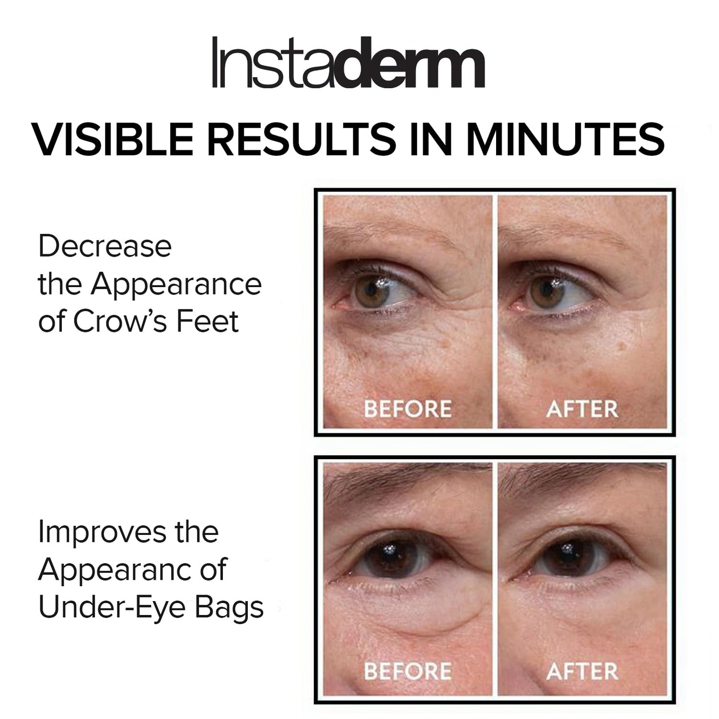 White Smoke Instant Eye Tightener – Instantly Reduces Under Eye Bags, Puffiness, Dark Circles, Wrinkles & Crow's Feet. Naturally Ageless Hydrating Cream. Disappears Before Your Eyes Within Minutes.