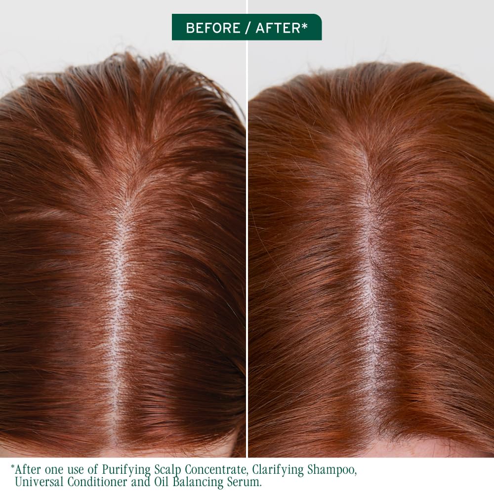 Saddle Brown Biolage Scalp Sync Oil Balancing Hair Serum - Absorbs Excess Oil Between Washes, Leave-In Scalp Treatment, Fermented Tea Blend, Vegan, 1.6 Fl Oz