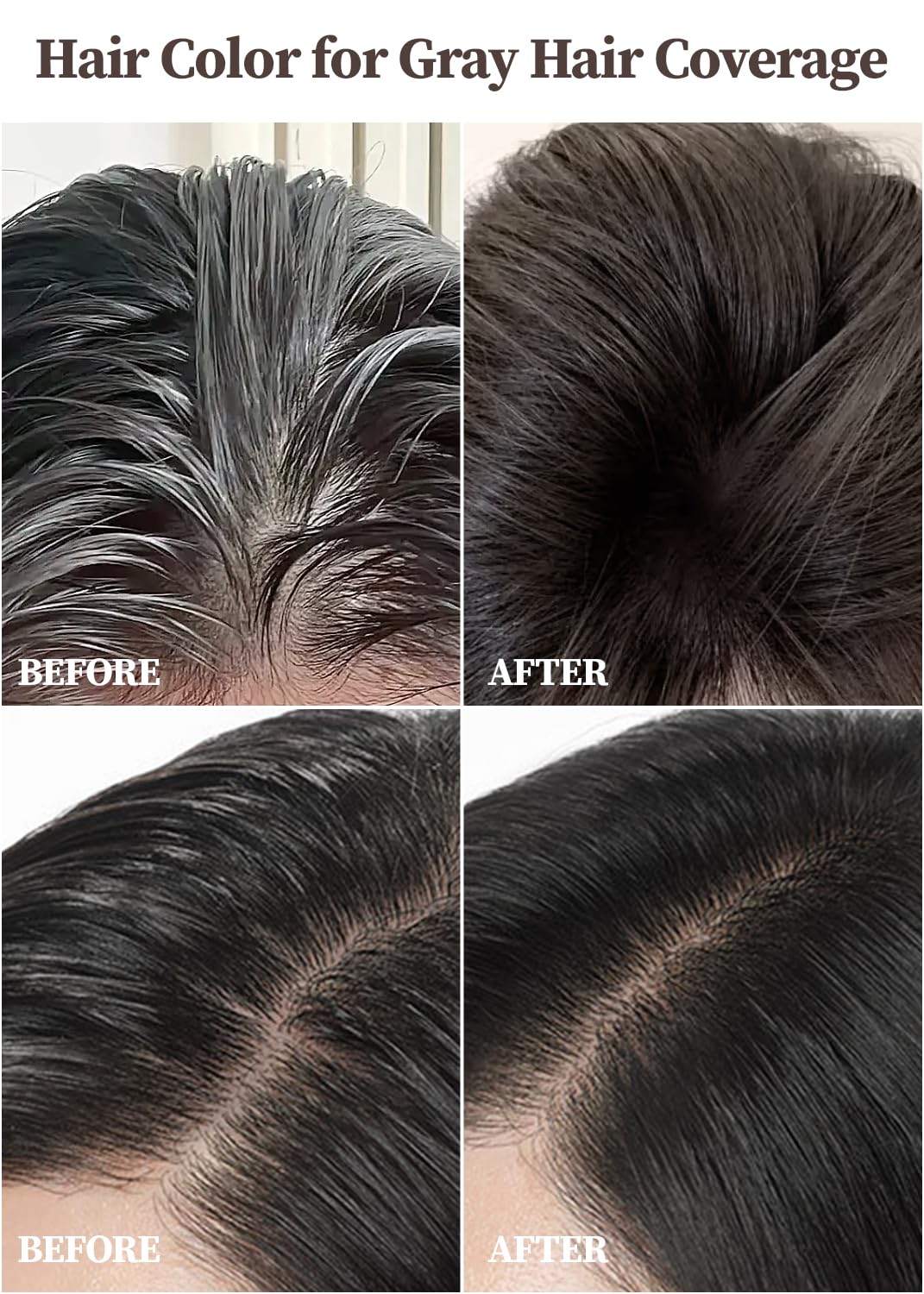 Dark Slate Gray HAARAZ Hair Dye + Ampoule Anti Hair Loss Treatment, Permanent Hair Color, 100% Gray Coverage, 2-Step Shampoo + 5-Minute Hair Color for Women & Men & Scalp Care Formula (BLACK)