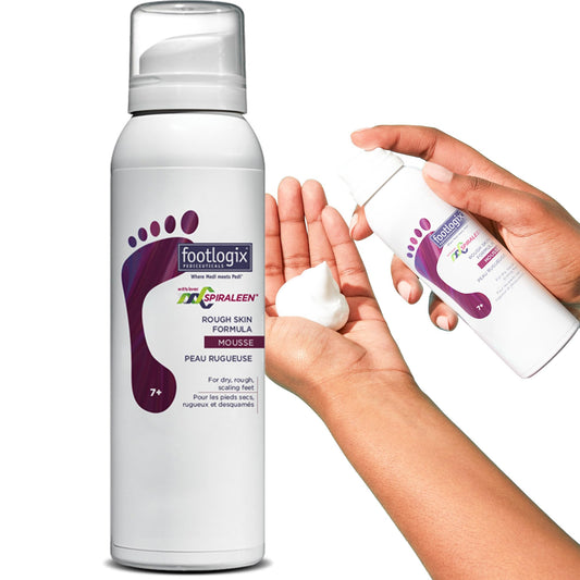 White Smoke Footlogix Rough Skin Formula with Spiraleen - Mousse for Dry Cracked Heels and Feet, Foot Care for Men and Women, Dry Cracked Feet Treatment, 4.23oz