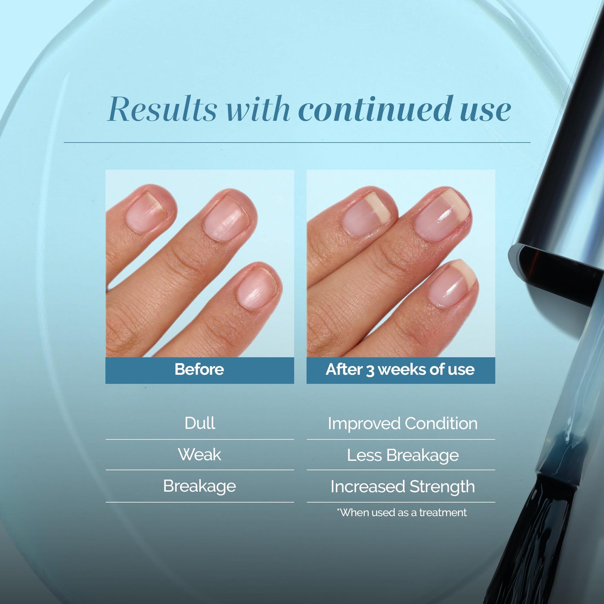 Pale Turquoise LONDONTOWN Get Strong Nail Hardener - Nail Strengthener Growth Treatment for Damaged Nails, Conditioning Nail Care for Long Healthy Nails, .40fl oz