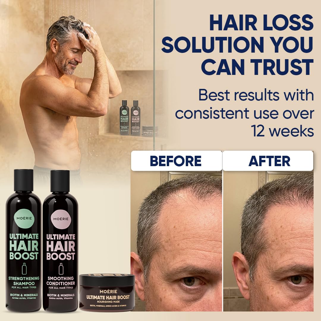 Light Gray Moérie Hair Growth Shampoo, Conditioner and Mask - Hair Loss Solution with Biotin and Rosemary, Thickening Hair Regrowth Set for Thinning Hair - Ultimate Hair Growth Care (Double Set)