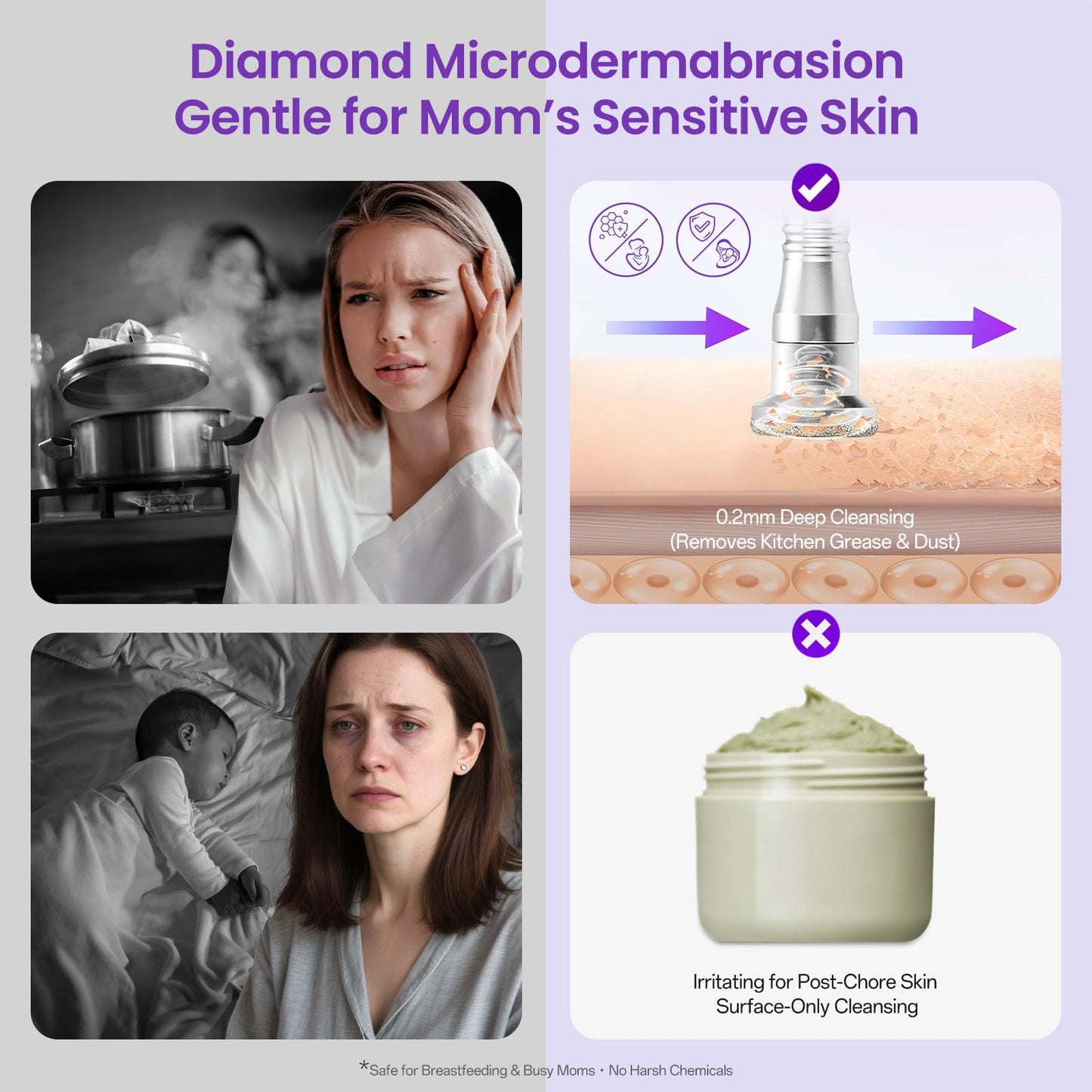 White Smoke UNOISETION Diamond Microdermabrasion Machine Professional, 3 in 1 Dermabrasion Facial Peeling Skin Care Device for Salon Personal Home Use