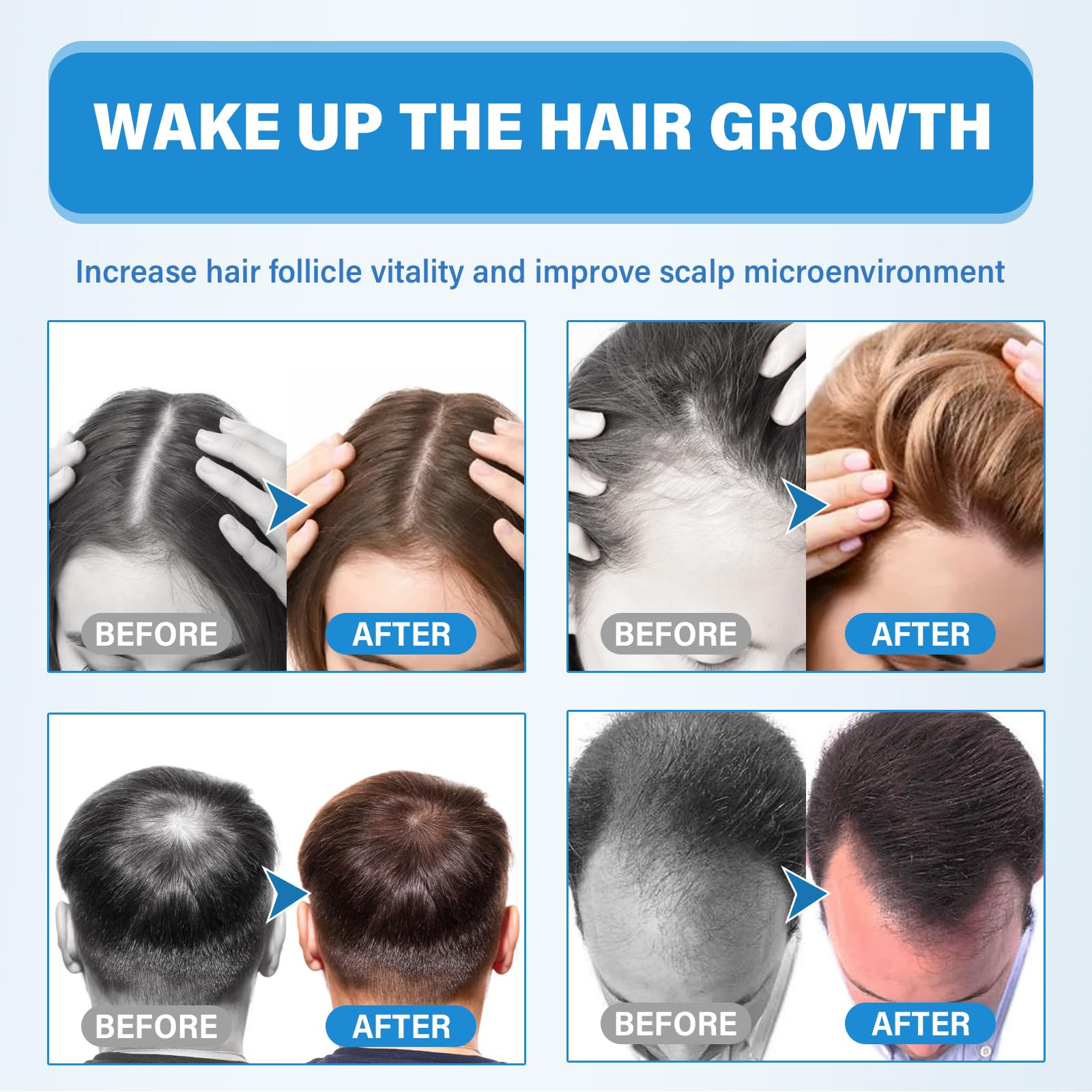 White Smoke Minoxidil for Men and Women, 5% Hair Growth Serum for Thinning Scalp, Non-Greasy Topical Spray for Thicker, Fuller-Looking Hair