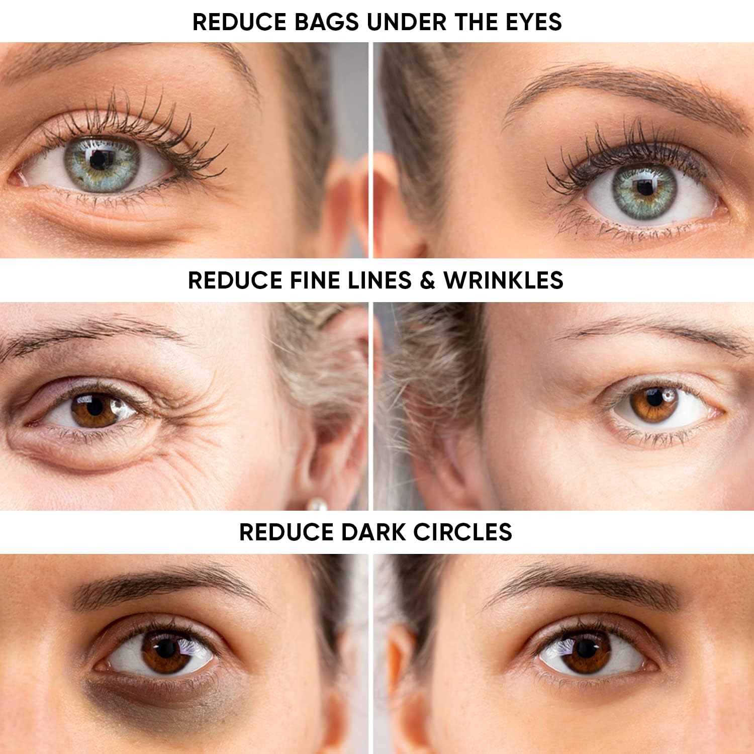 White Smoke Instant Eye Tightener – Instantly Reduces Under Eye Bags, Puffiness, Dark Circles, Wrinkles & Crow's Feet. Naturally Ageless Hydrating Cream. Disappears Before Your Eyes Within Minutes.