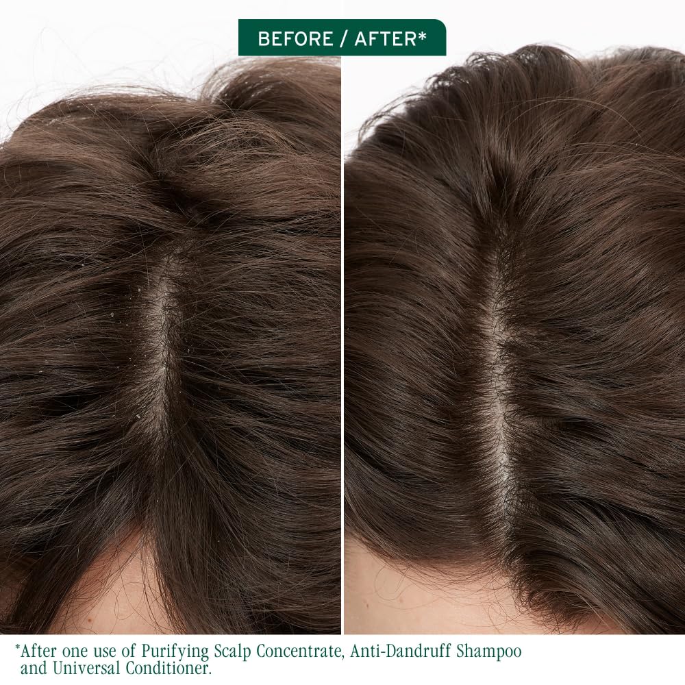 Dark Slate Gray Biolage Scalp Sync Purifying Concentrate - Exfoliating & Clarifying Dry Scalp Treatment, Refreshing & Reinvigorating, Fermented Tea Blend & Glycolic Acid