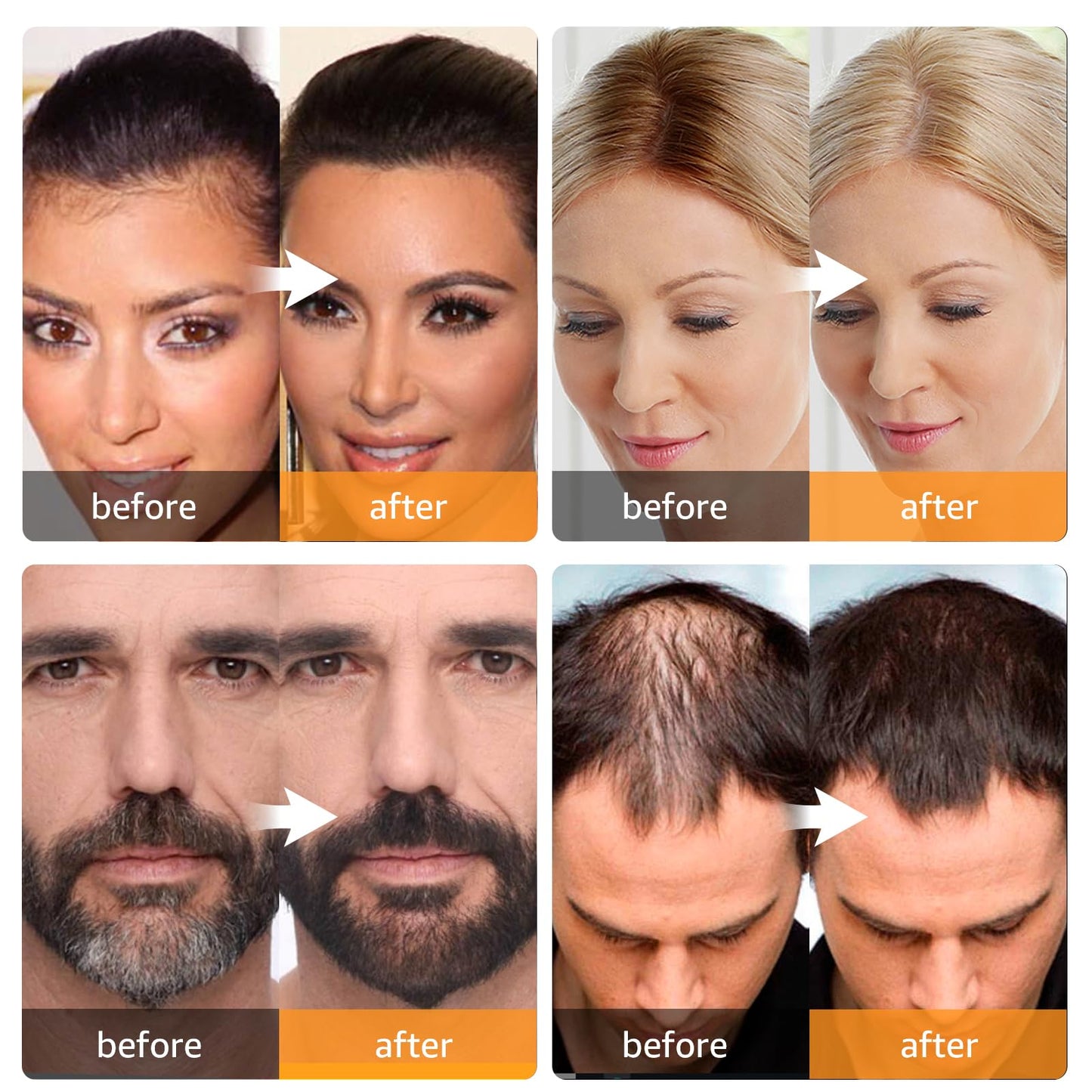 Tan Abomet Root Touch Up Instantly Gray Hair Coverage Hairline Powder for Women & Men, Medium Brown for Concealing Hair Loss & Thinning Hair