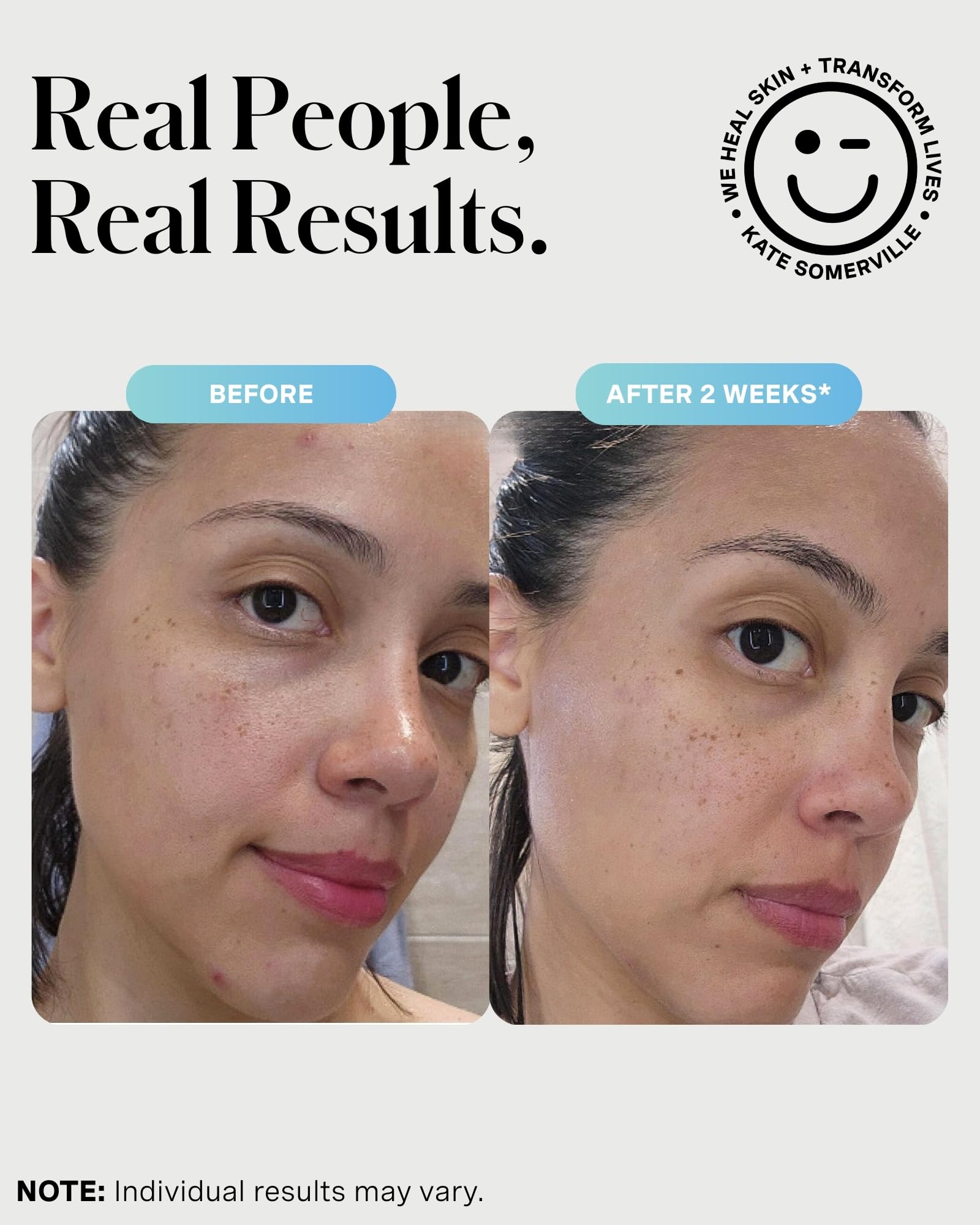 Lavender Kate Somerville EradiKate 3% Sulfur Daily Foaming Cleanser Acne Treatment – Clinically Formulated Medicated Face Wash Balances Skin & Cleans Pores, 4 Fl Oz