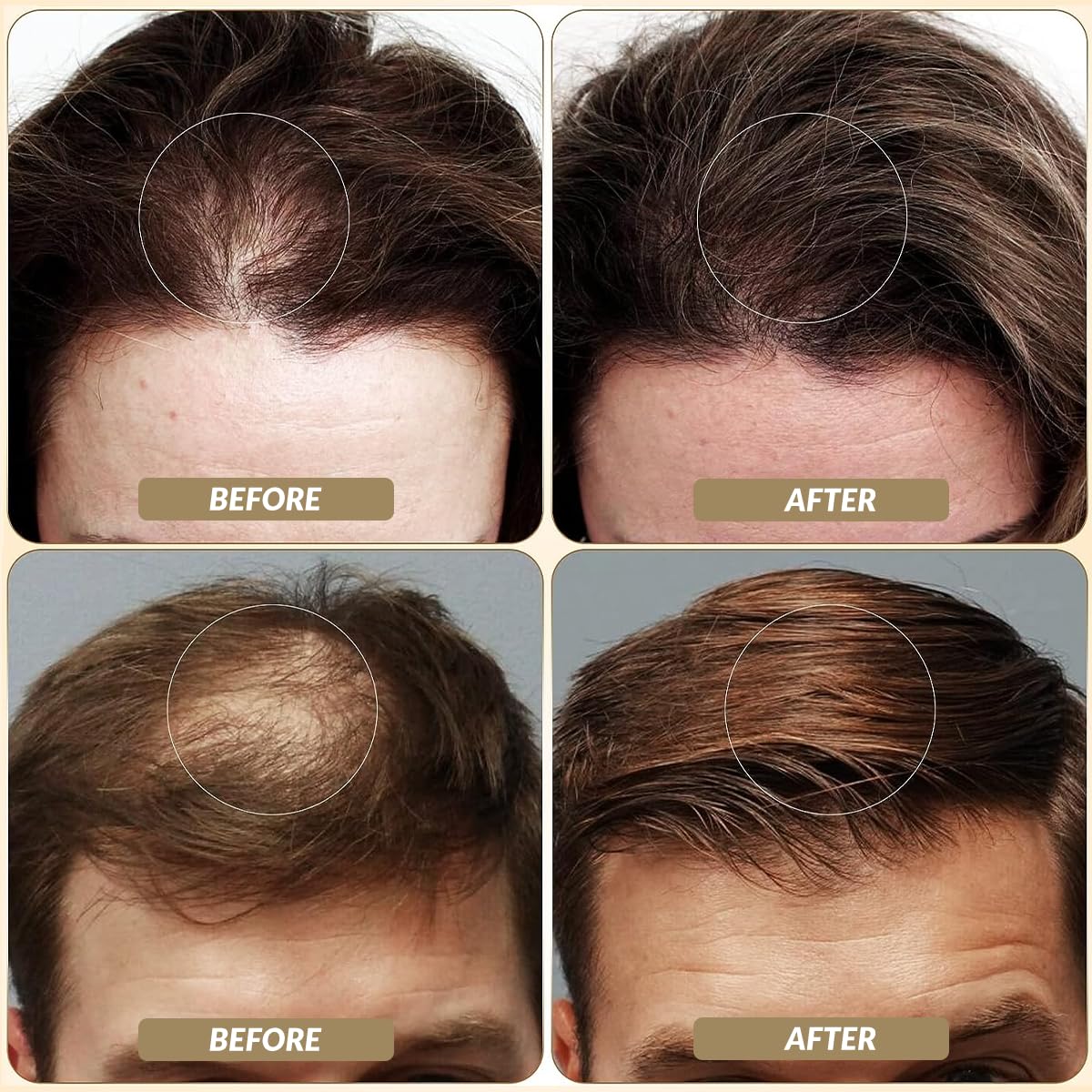 Black SOVONCARE Hair Fibers for Thinning Hair, Black Hair Building Fibers for Bald Spots Undetectable & Natural, Conceals Hair Loss, Fill In Fine Hair Powder Hair Thicker Instantly for Women & Men 28g