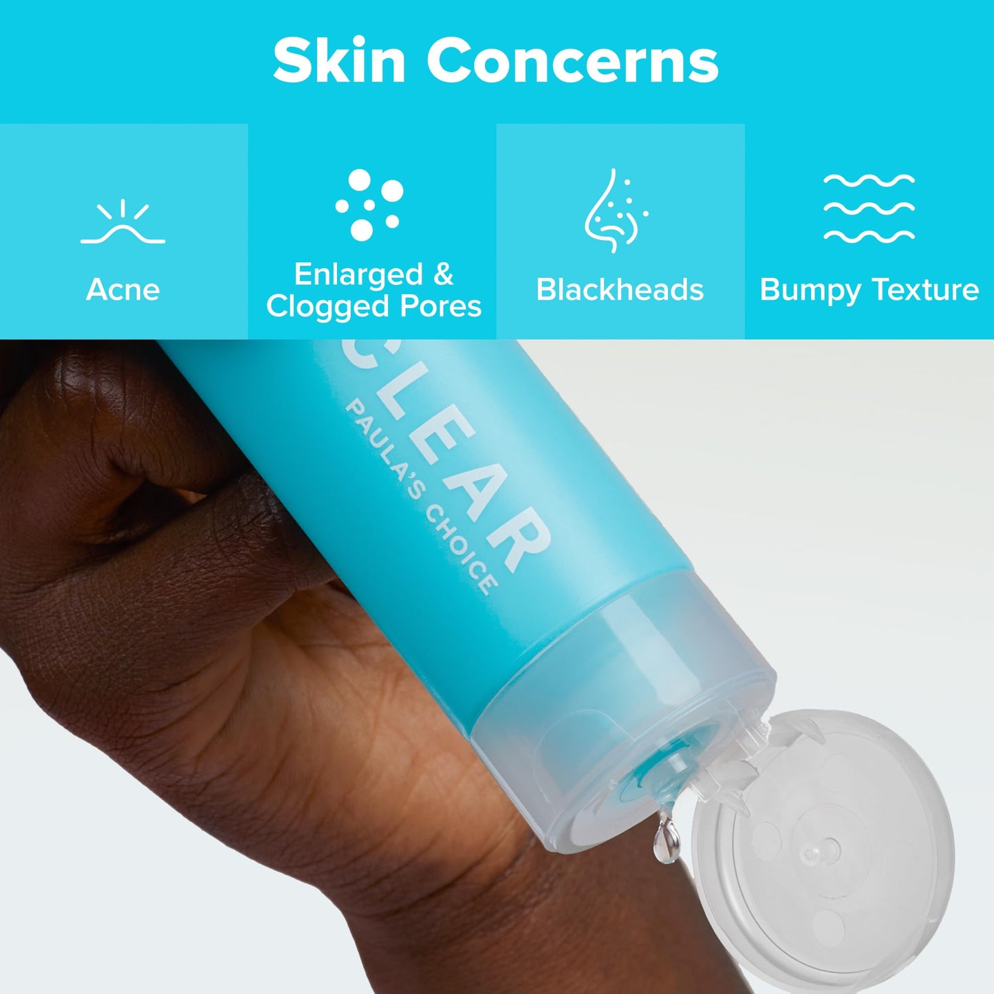 Lavender Paula's Choice CLEAR Anti-Redness Exfoliating Solution, 2% Salicylic Acid Liquid Exfoliant for Face, Face Exfoliant for Mild to Severe Acne & Breakouts, Blackhead-Prone Skin, Fragrance-Free