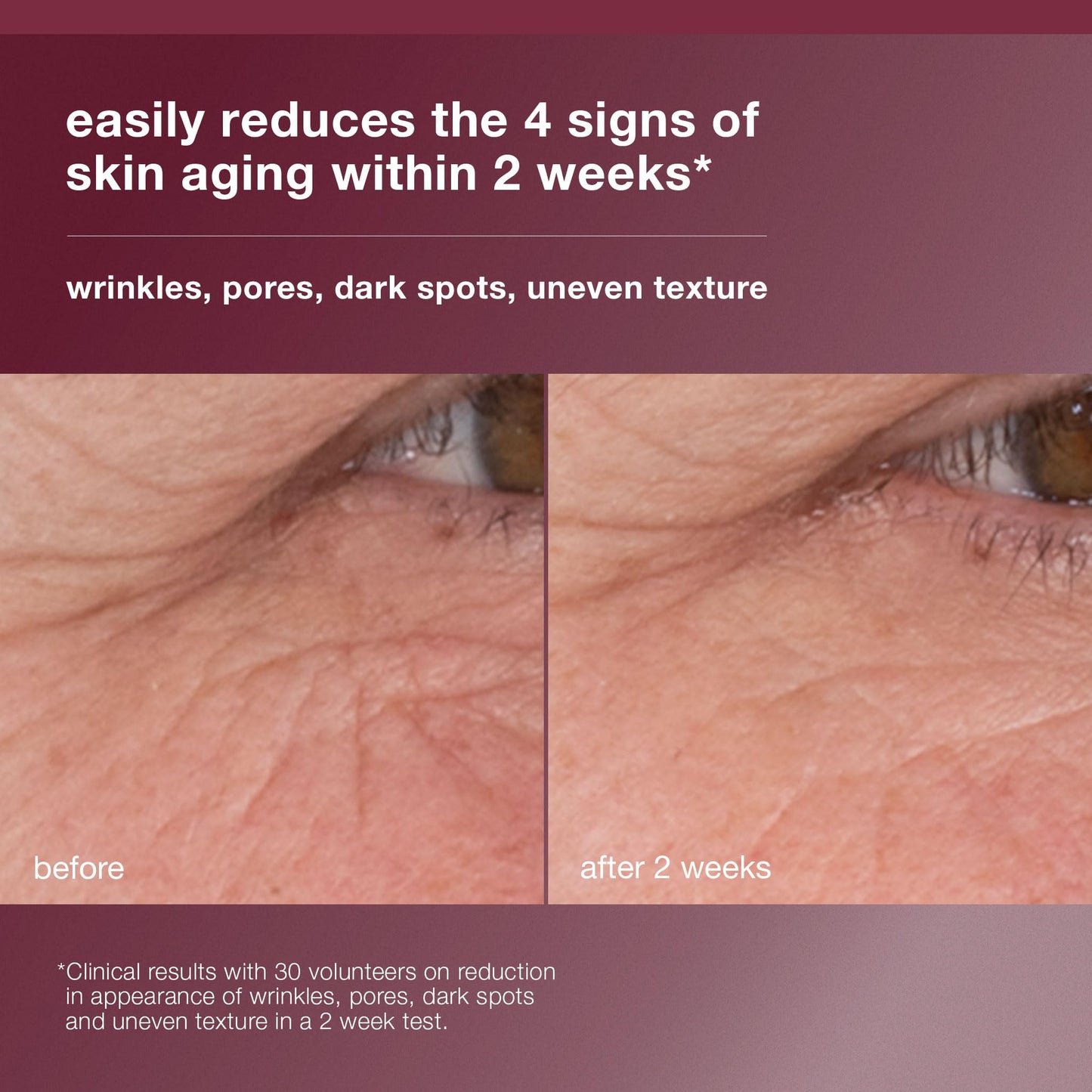 Dark Salmon Dermalogica Dynamic Skin Retinol Facial Serum with Multi-Retinoid Complex, Skin Retexturizing and Improving Skin Health, 0.34 lf oz