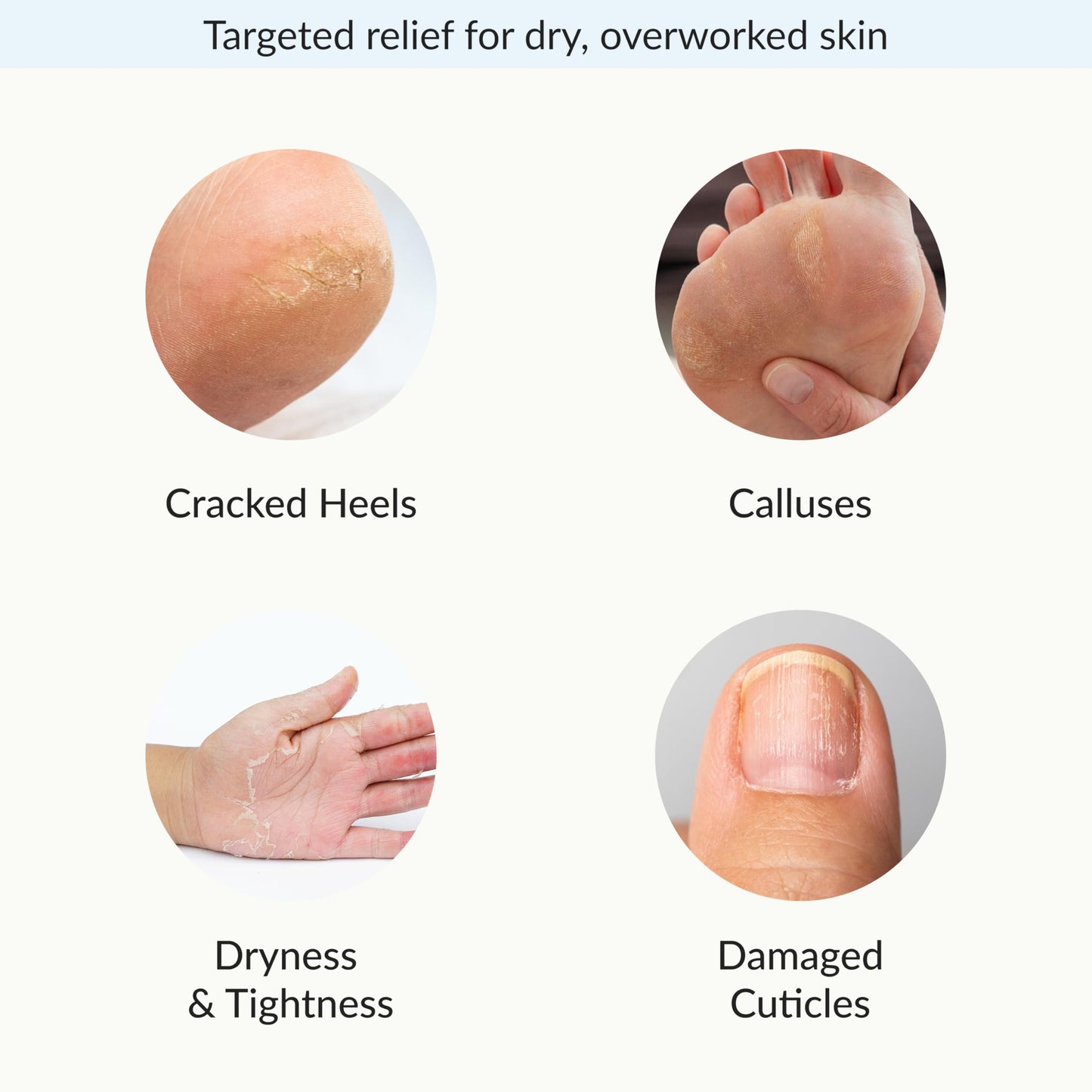 White Smoke Epielle Intensive Repairing Hand & Foot Masks, Restore and Moisturize Dry, Cracked Skin, Self Care Gifts for Women, Spa Kit, Mothers Day Gifts, 6 Moisturizing Gloves & 6 Moisturizing Socks