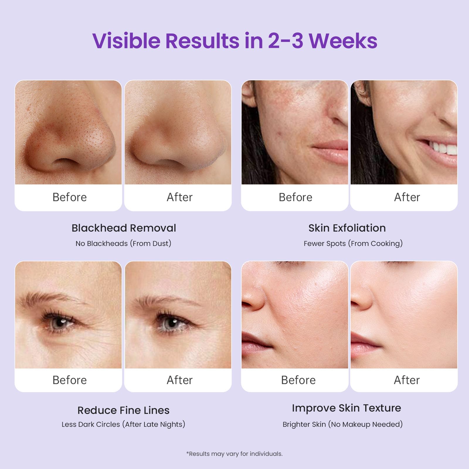 Lavender UNOISETION Diamond Microdermabrasion Machine Professional, 3 in 1 Dermabrasion Facial Peeling Skin Care Device for Salon Personal Home Use