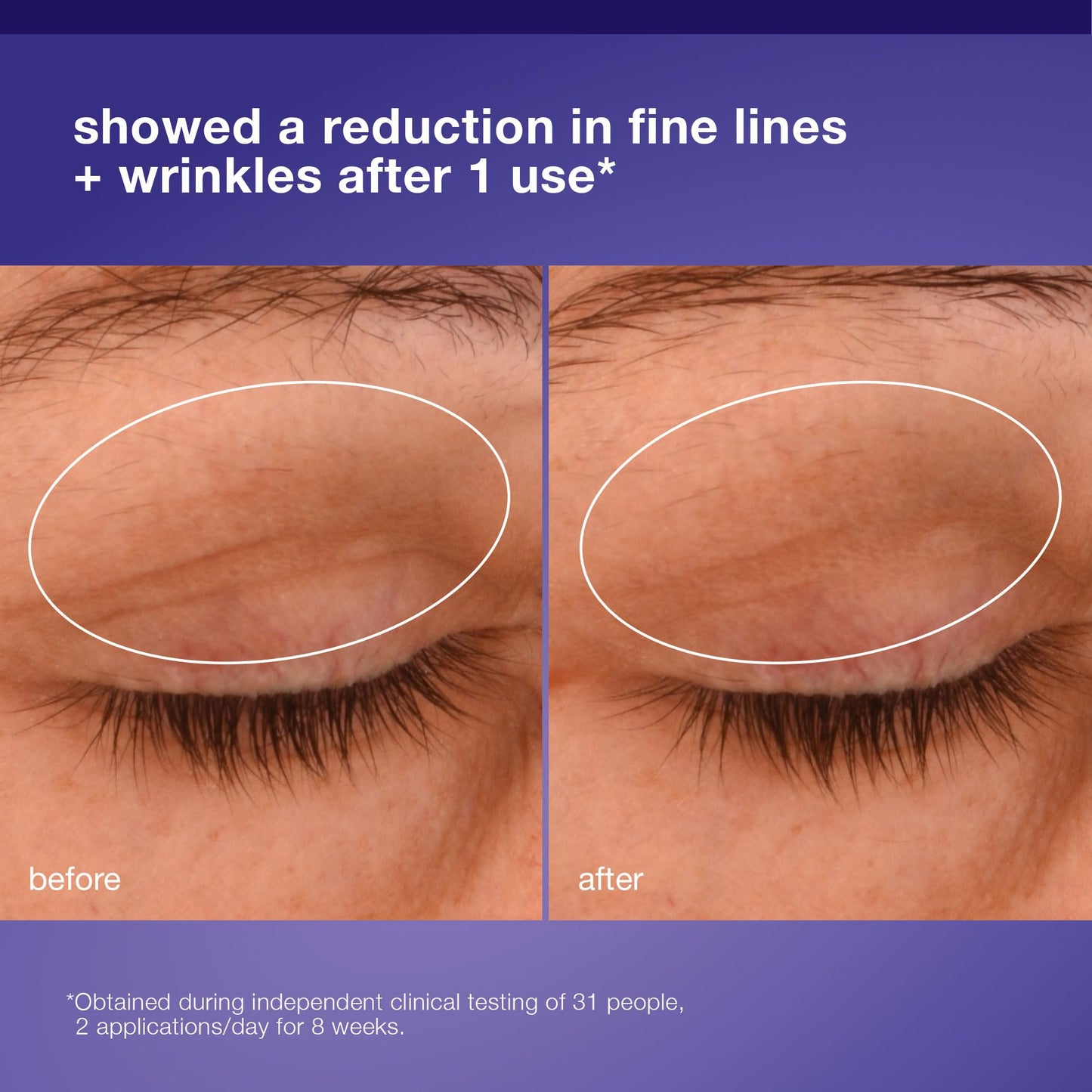 Dark Salmon Dermalogica Phyto Nature Lifting Eye Cream, Skin Treatment Serum for Around Eyes - Reduces the Appearance of Fine Lines and Wrinkles