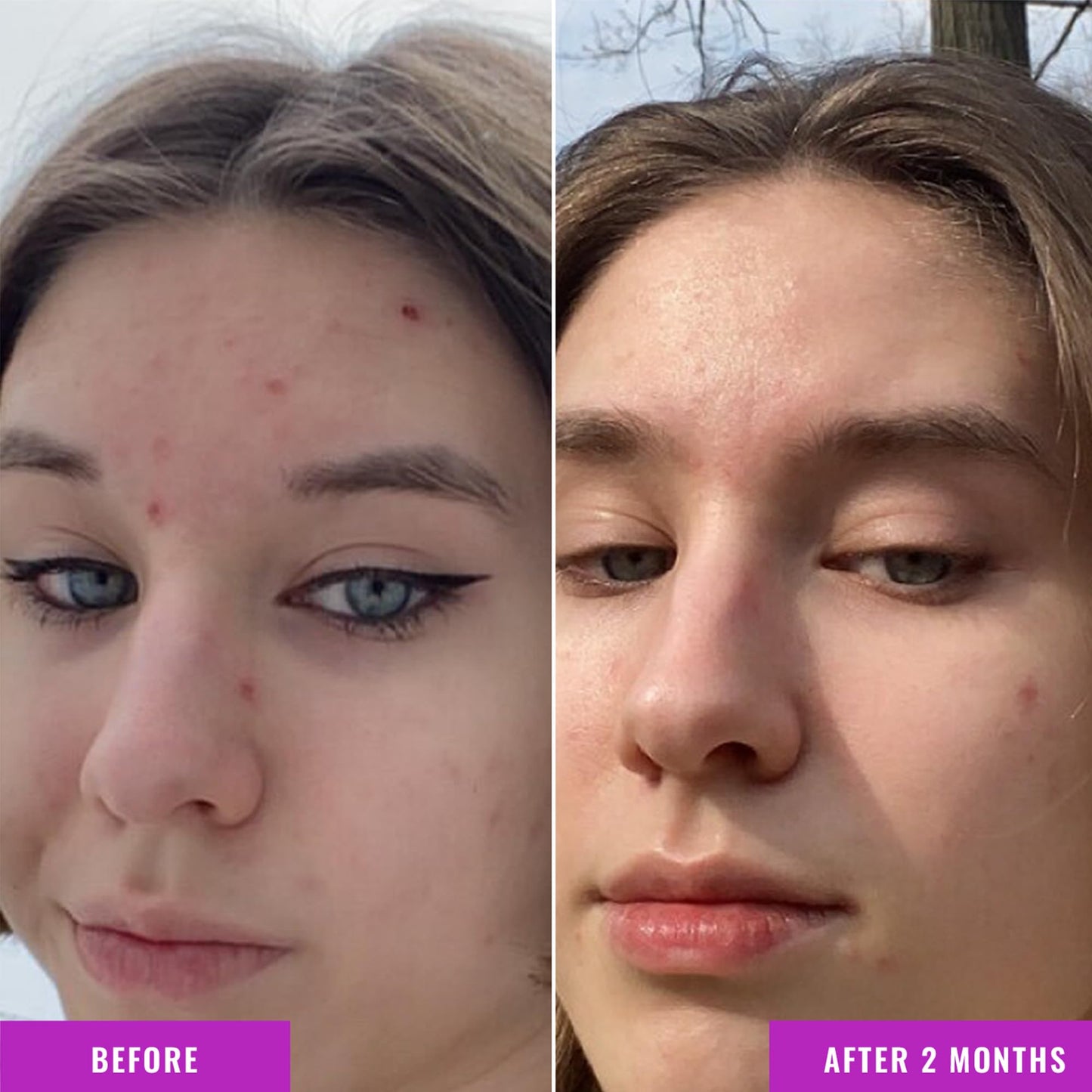 Dim Gray Good Molecules Niacinamide Serum - 10% Niacinamide to Target Blemishes, Nourishment, and Skin Tone - Ultra Hydrating Serum and Brightening Skin Care for Face