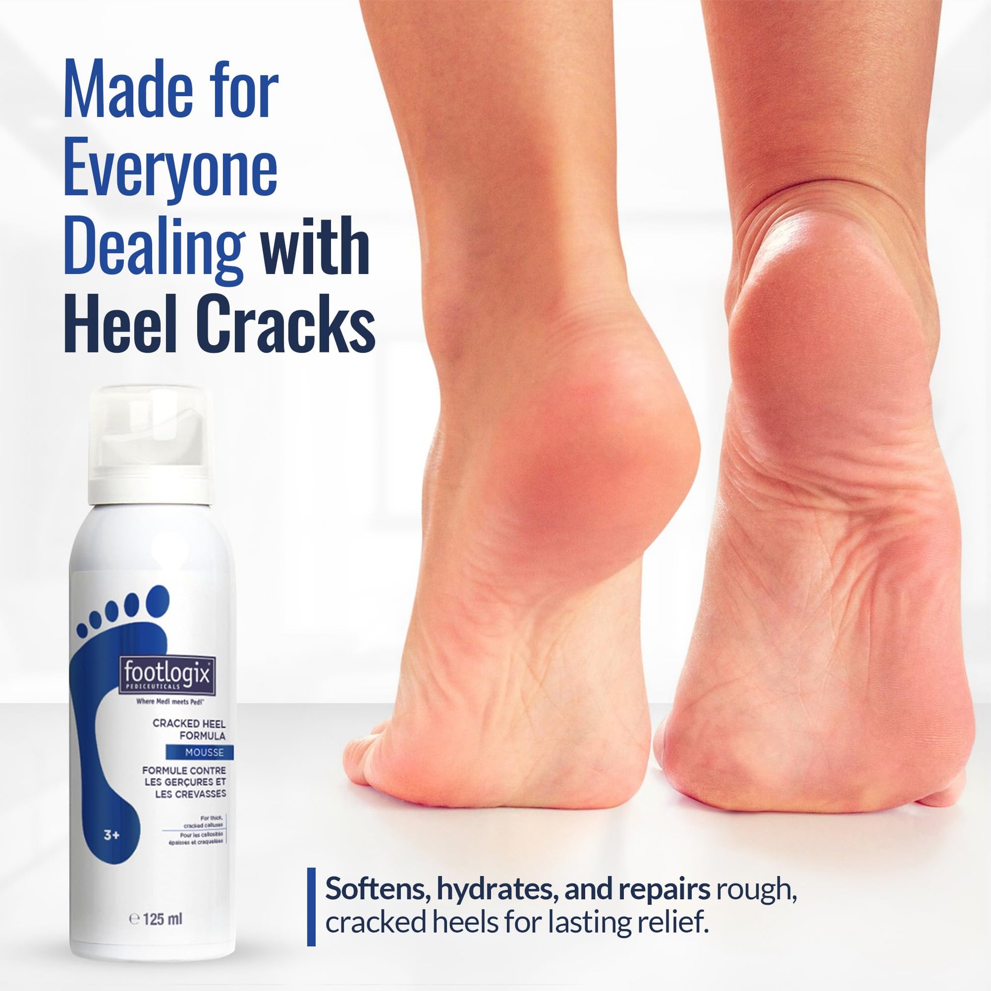 White Smoke FOOTLOGIX Cracked Heel Formula, White 4.23 Ounce