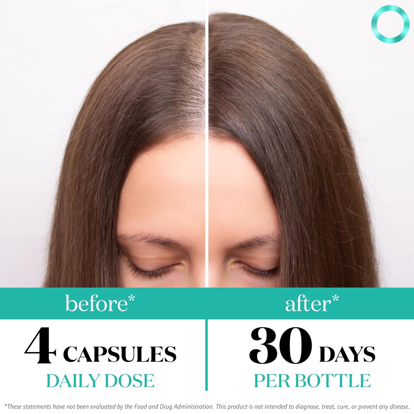 White Smoke Women's Balance Hair Growth Supplements, Ages 45 and Up, Customer Proven for Visibly Thicker Hair and Scalp Coverage, Soy-Free, Made with 26 Ingredients including Beta Carotenes - 2 Month Supply