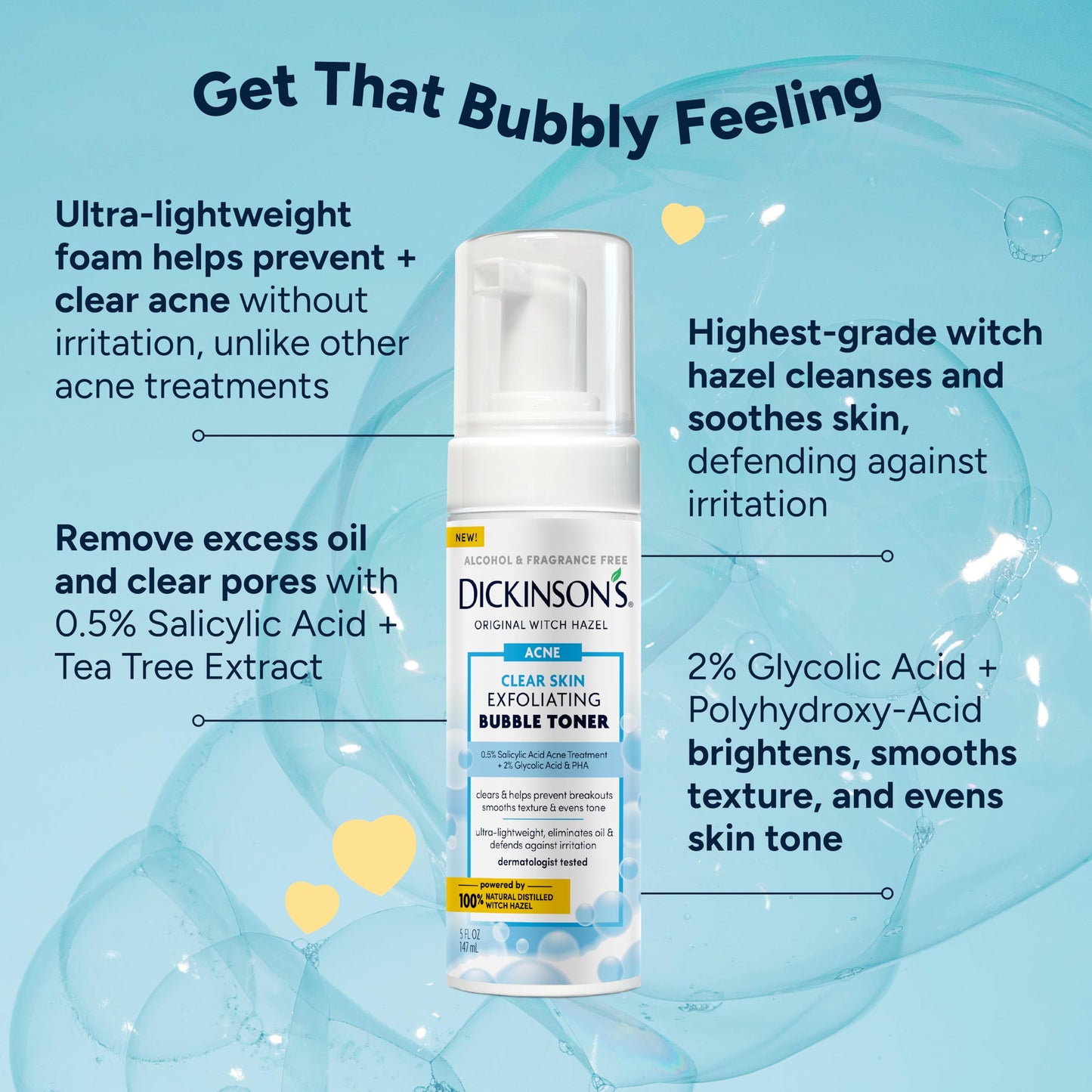 Light Blue Dickinson’s Witch Hazel Exfoliating Bubble Toner with 0.5% Salicylic Acid, Glycolic Acid & Niacinamide | Clears Pores, Smooths Texture, Brightens Skin | Alcohol-Free, Fragrance-Free | 5 Fl Oz