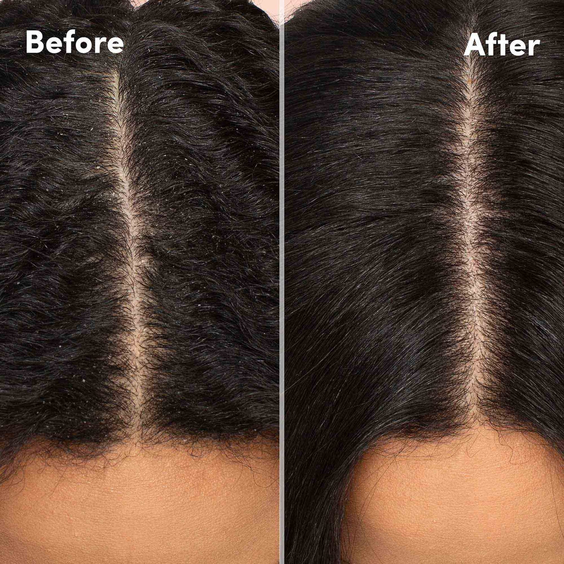 Black Mizani Scalp Care Calming Scalp Lotion - Soothing Dandruff Treatment, Anti Flake, With Eucalpytus, Avocado Oil & Menthol, Silicone-Free, Paraben-Free