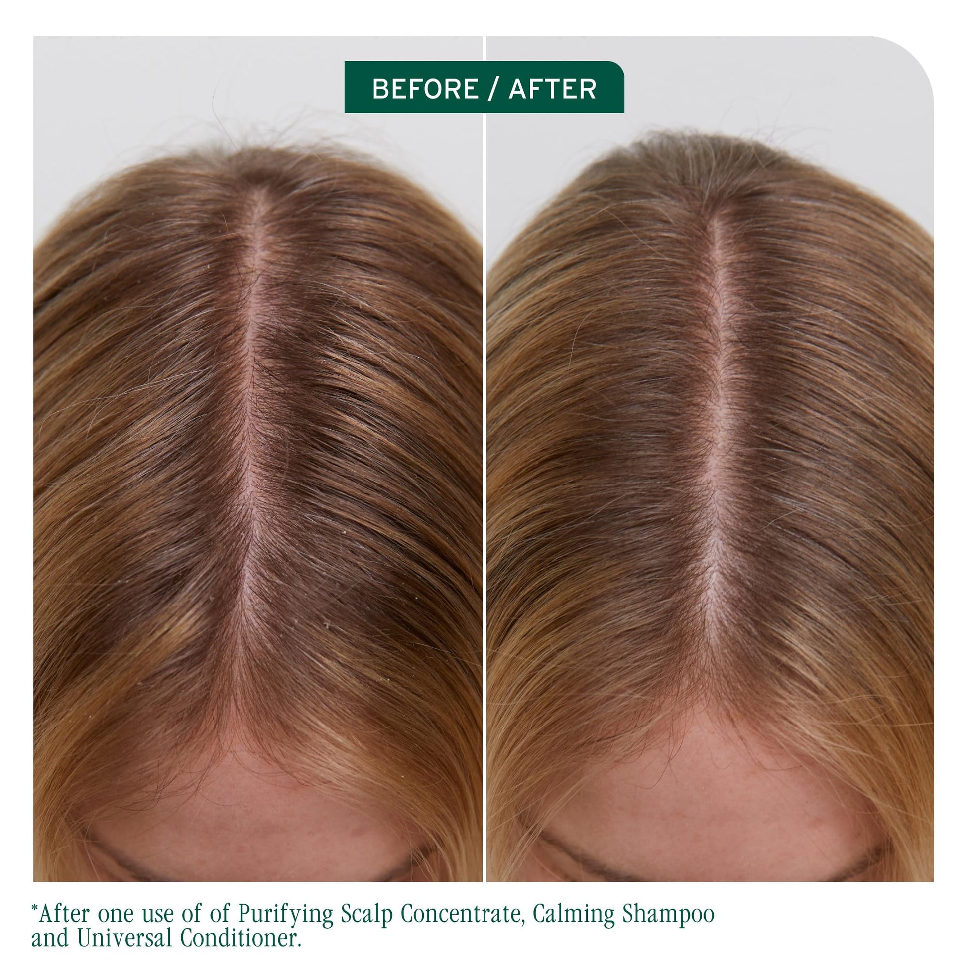 Dark Olive Green Biolage Scalp Sync Calming Shampoo - Gently Cleanses Dry & Sensitive Scalps, Hydrates & Soothes, Fermented Tea Blend & Glycolic Acid, Vegan & Paraben-Free