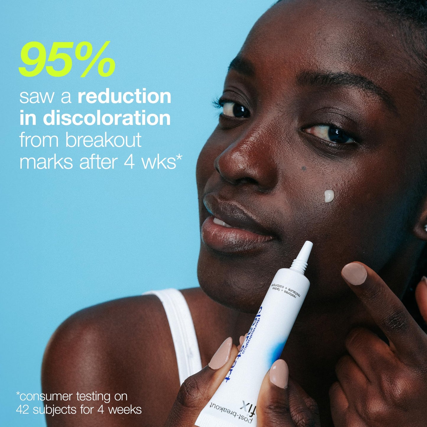 Sky Blue Dermalogica Clear Start Post-Breakout Fix, Acne Dark Spot Treatment with Salicylic Acid, Squalene & Hexylresorcinol, Fade + Brighten Acne Marks