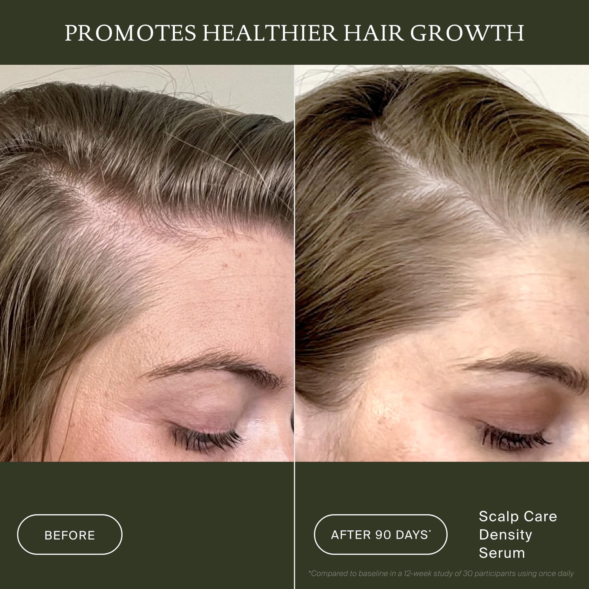 Dark Slate Gray Living Proof Scalp Care Density Serum