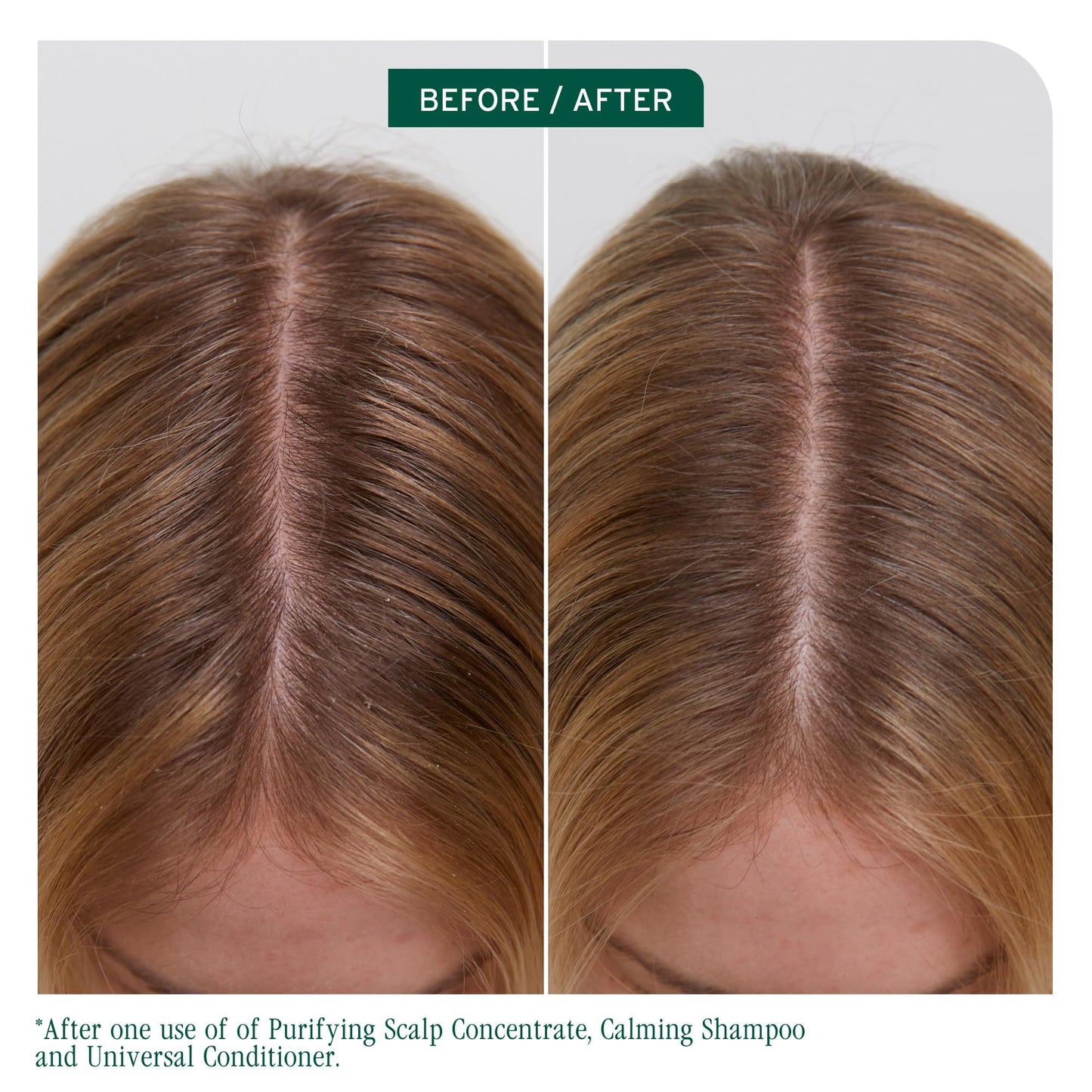 Dark Olive Green Biolage Scalp Sync Universal Conditioner - Nourishing & Hydrating for All Scalp Types, Lightweight Moisturizing & Conditioning, Fermented Tea Blend & Glycolic Acid, Vegan & Paraben-Free, 33.8 Fl Oz