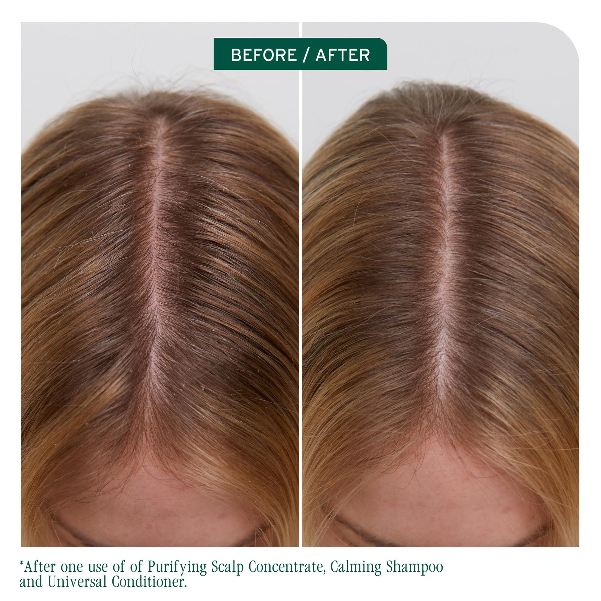 Dark Olive Green Biolage Scalp Sync Universal Conditioner - Nourishing & Hydrating for All Scalp Types, Lightweight Moisturizing & Conditioning, Fermented Tea Blend & Glycolic Acid, Vegan & Paraben-Free, 33.8 Fl Oz