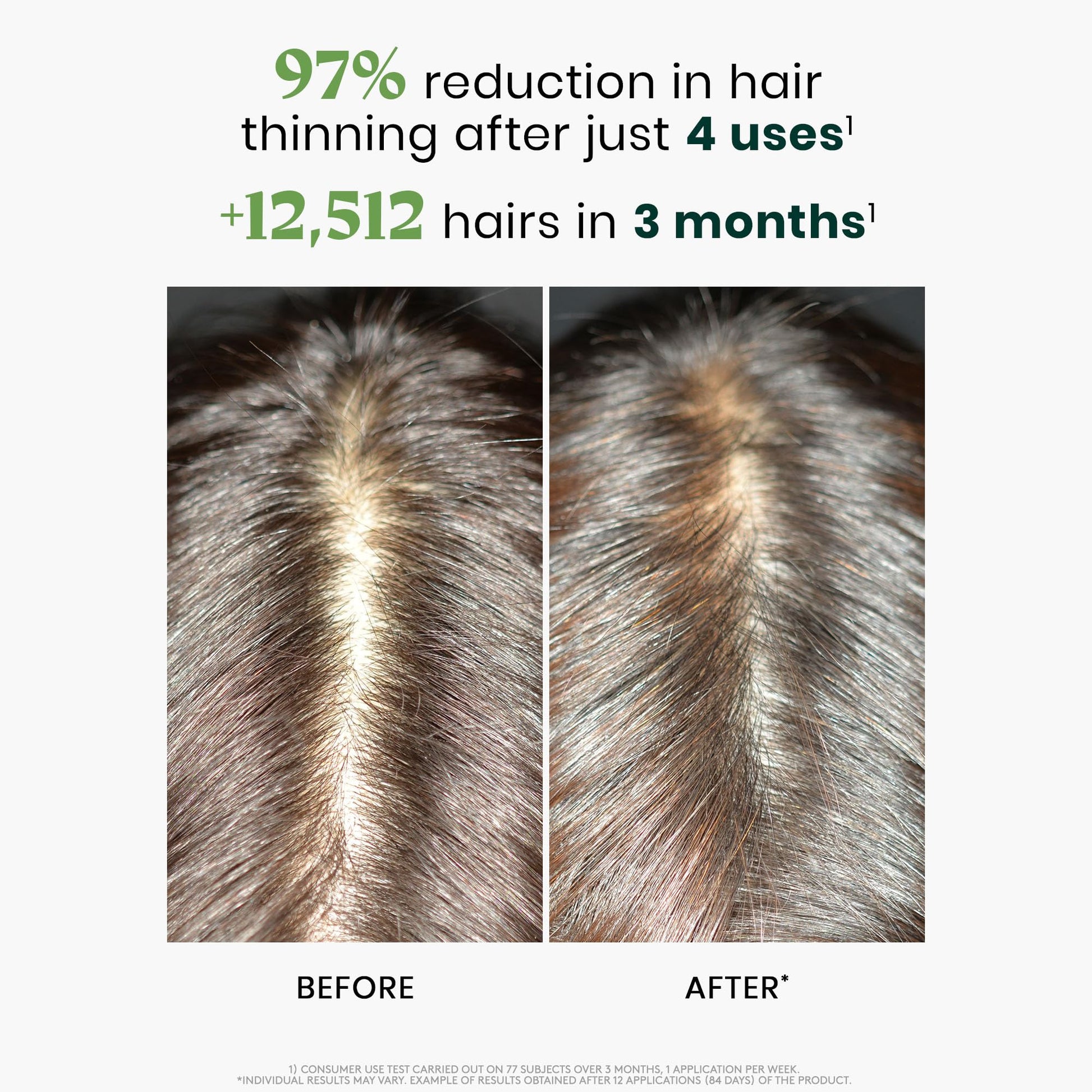 White Smoke Rene Furterer Triphasic Reactional Concentrated Serum - Thinning Hair caused by stress, postpartum, seasonal change - Drug-Free - Breastfeeding Safe - Dermatologist tested - 12 ct., 3-Month Supply