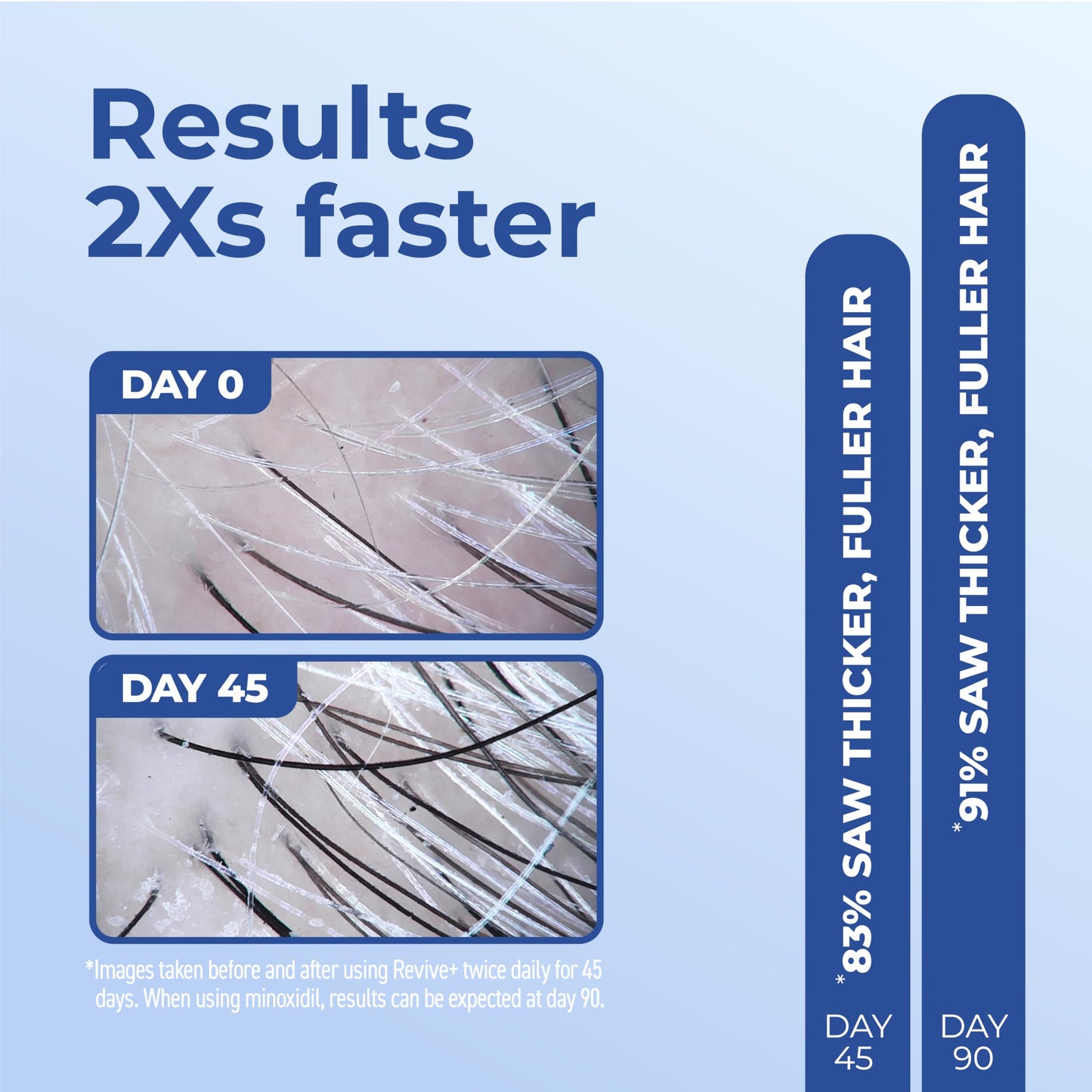 Lavender Bosley Revive+ Densifying Serum for Men – Drug-Free Hair Regrowth Treatment – Biotin, Saw Palmetto, Pumpkin Seed, Y100 Botanical Compound – Thicker, Fuller Hair in 45 Days – 1 Month Supply