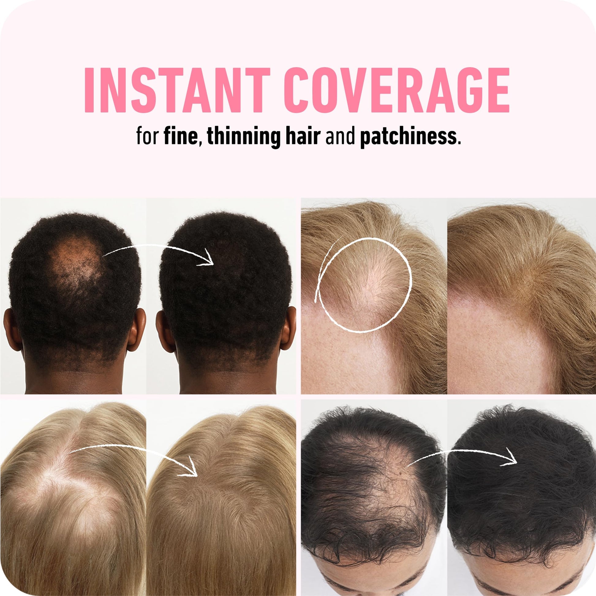 White Smoke BOLDIFY Hair Fibers (12g) - Fill In Thinning and Fine Hair for an Instantly Fuller, Thicker Look - 14 Shades for Women & Men - Dark Brown